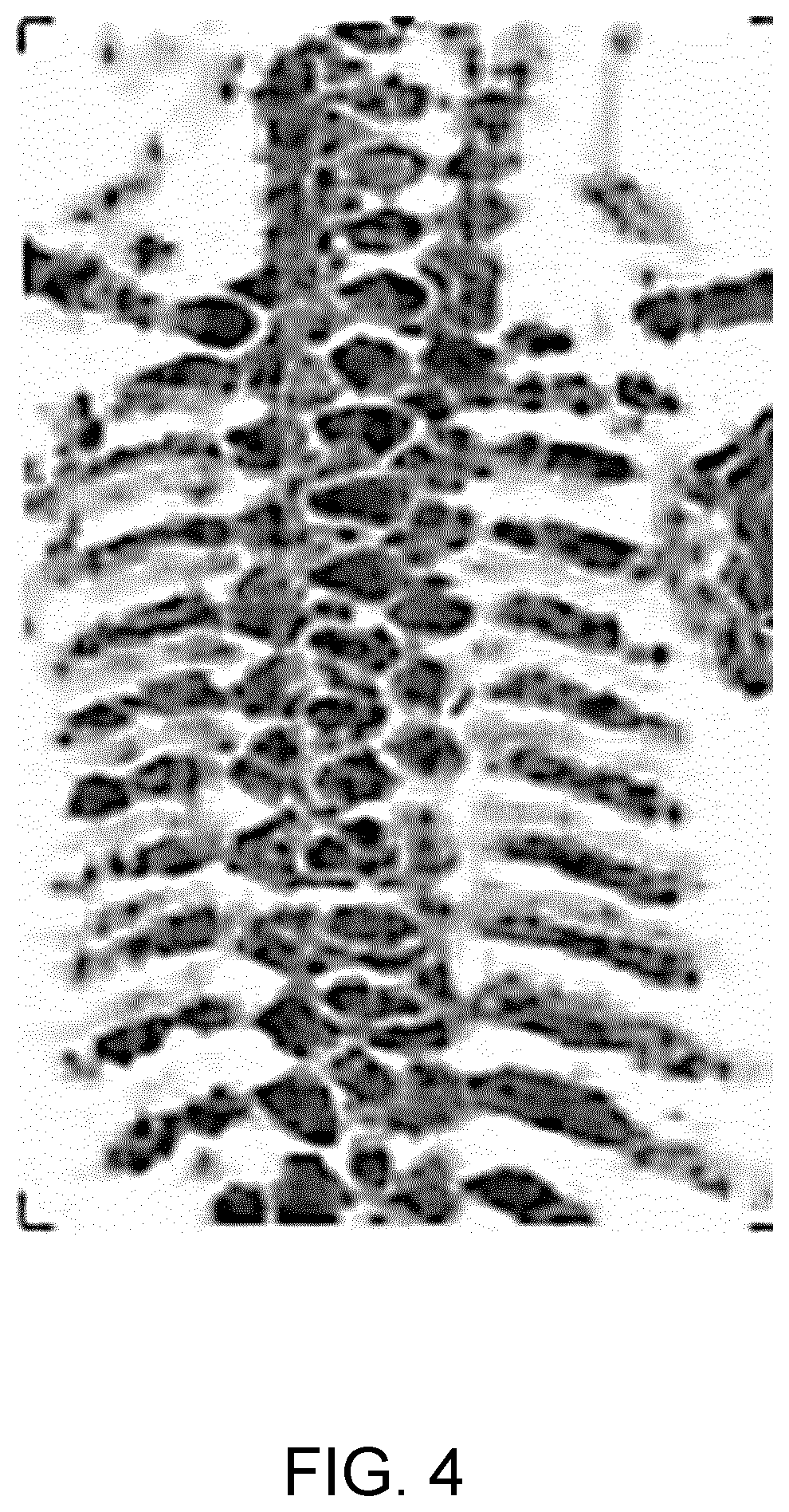 Patent US12611165 Figure 3 – Fetal ultrasound image processing