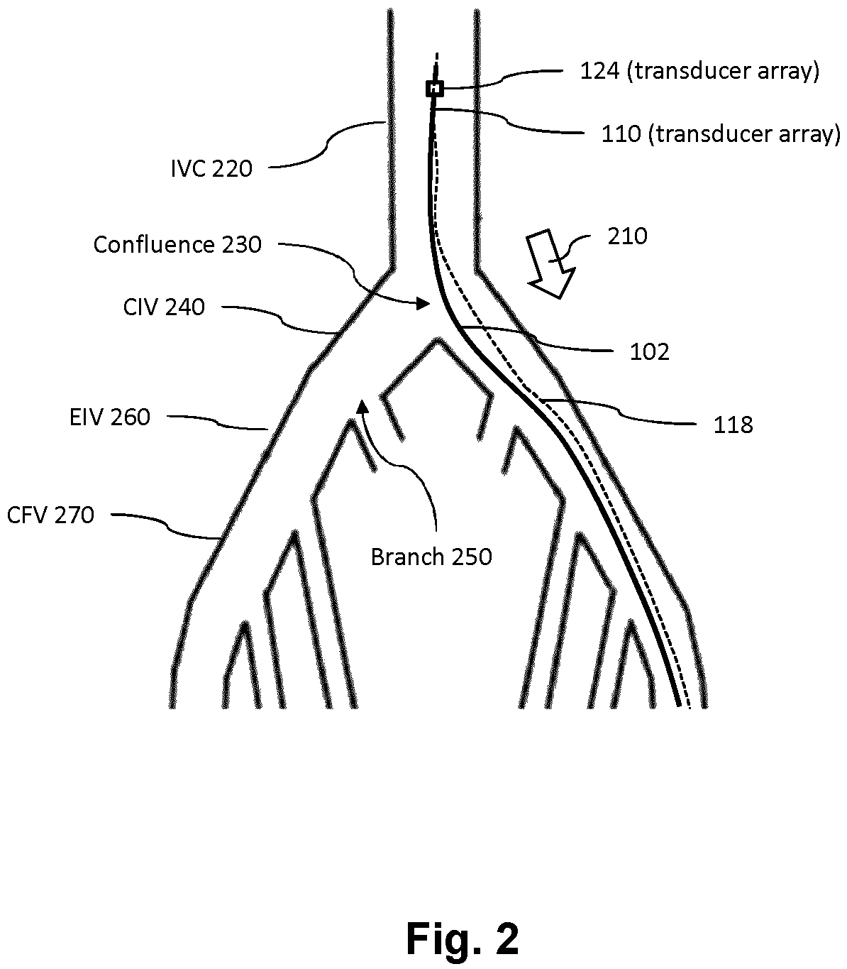 Patent US12611166 Figure 2 – Intraluminal ultrasound vessel segment identification and associated devices, systems, and methods