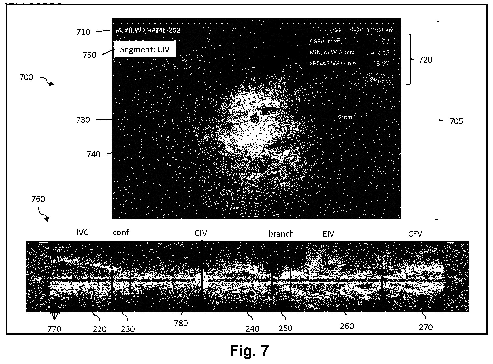 Patent US12611166 Figure 7 – Intraluminal ultrasound vessel segment identification and associated devices, systems, and methods
