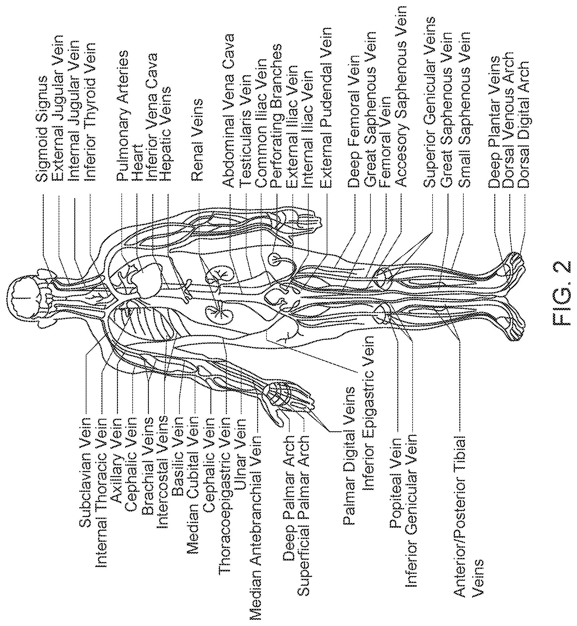 Patent US12611169 Figure 2 – Intraluminal ultrasound imaging with automatic and assisted labels and bookmarks