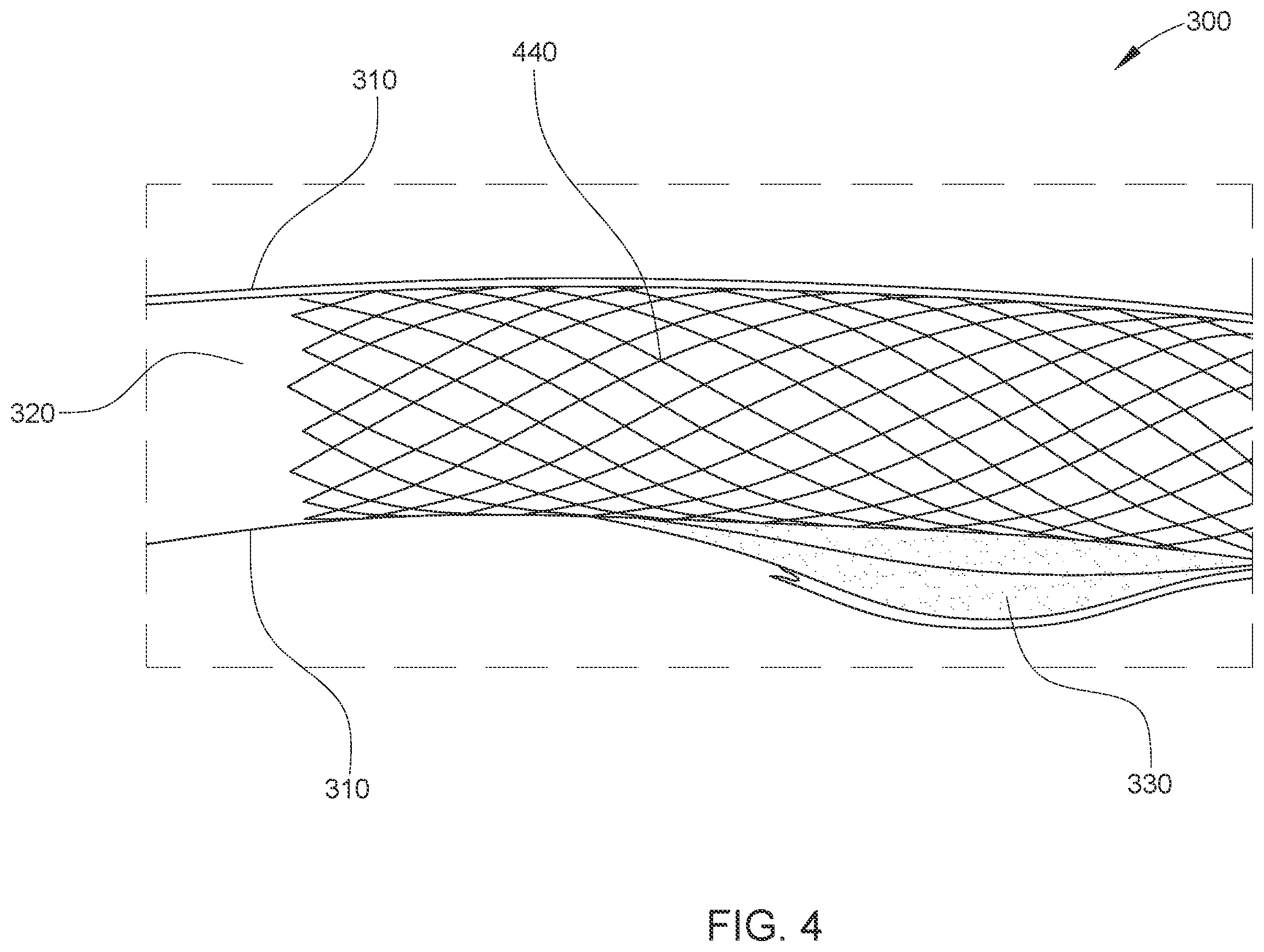 Patent US12611169 Figure 4 – Intraluminal ultrasound imaging with automatic and assisted labels and bookmarks