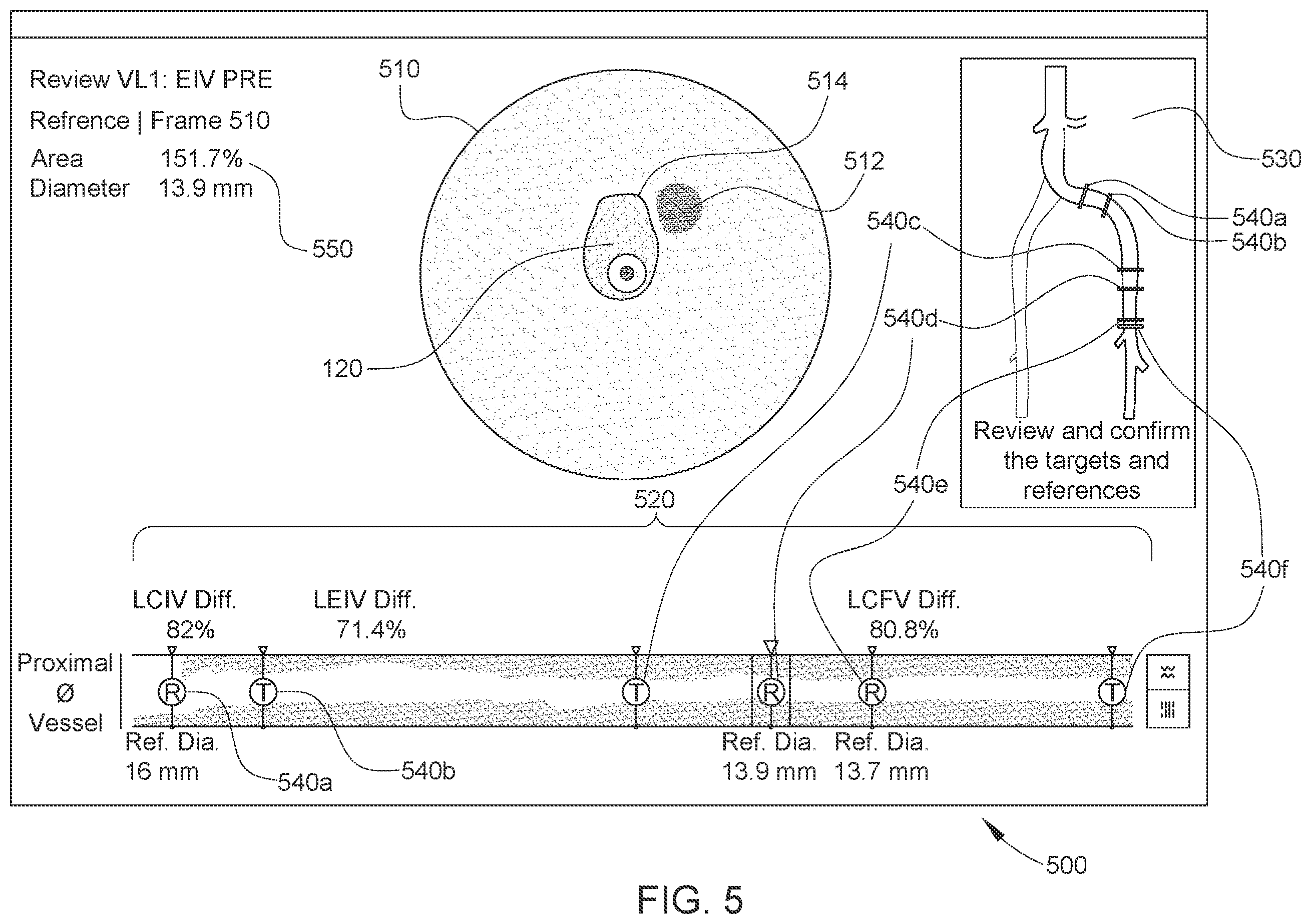 Patent US12611169 Figure 5 – Intraluminal ultrasound imaging with automatic and assisted labels and bookmarks