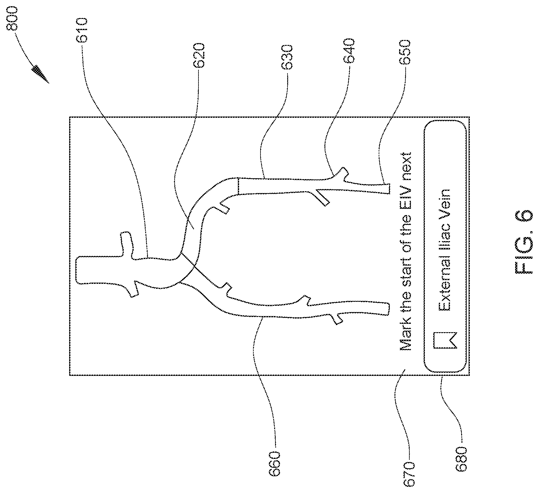Patent US12611169 Figure 6 – Intraluminal ultrasound imaging with automatic and assisted labels and bookmarks
