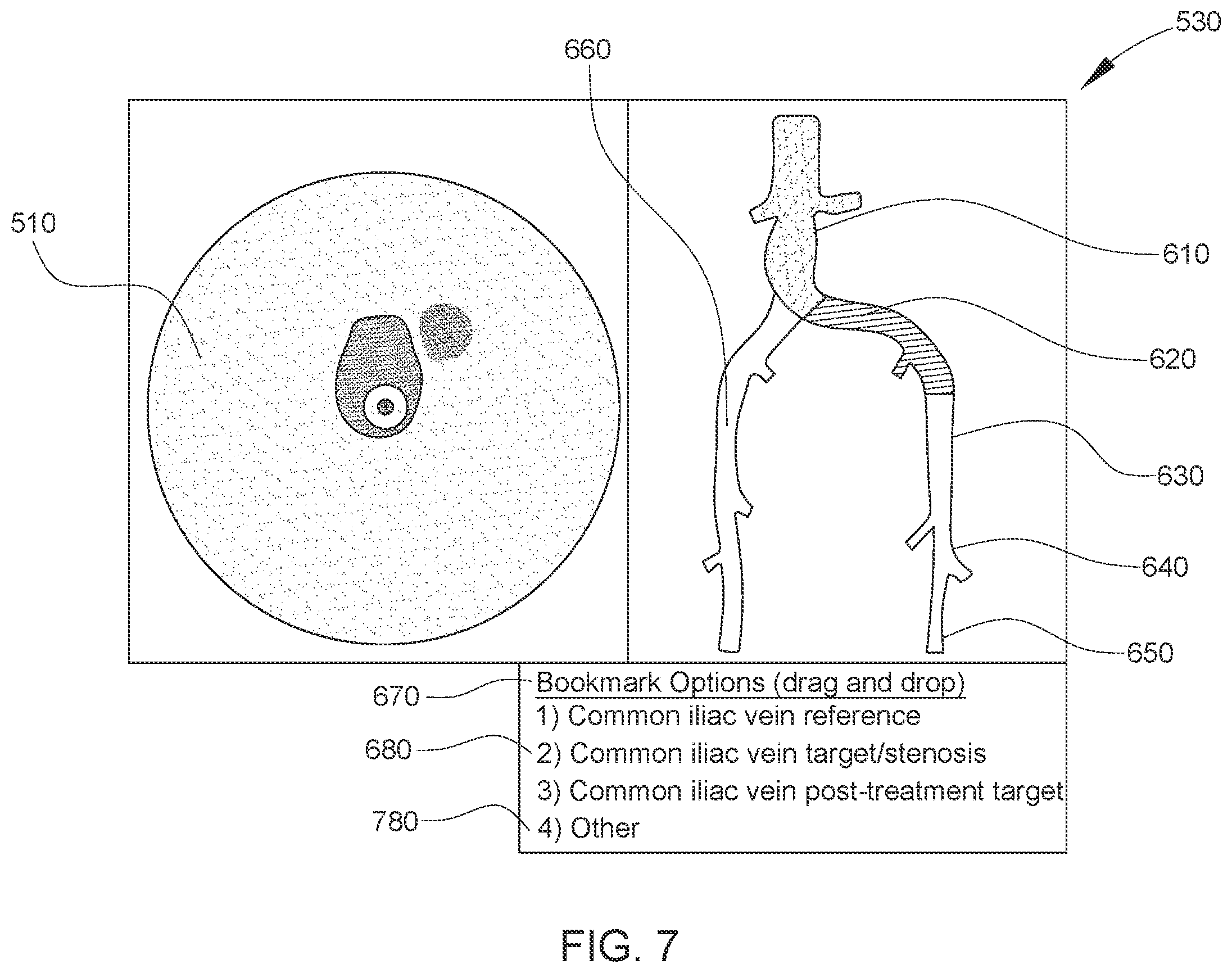 Patent US12611169 Figure 7 – Intraluminal ultrasound imaging with automatic and assisted labels and bookmarks