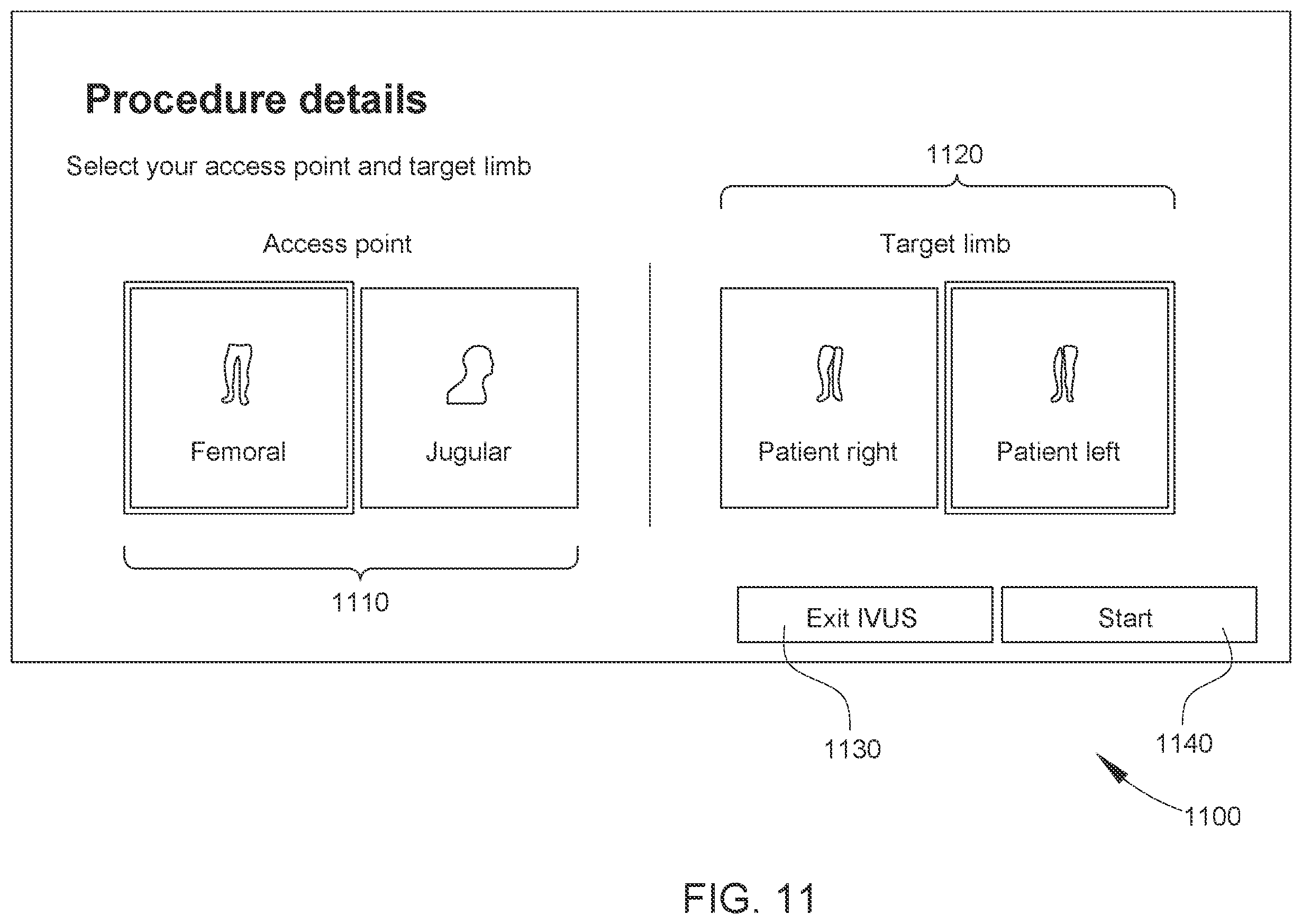 Patent US12611169 Figure 11 – Intraluminal ultrasound imaging with automatic and assisted labels and bookmarks