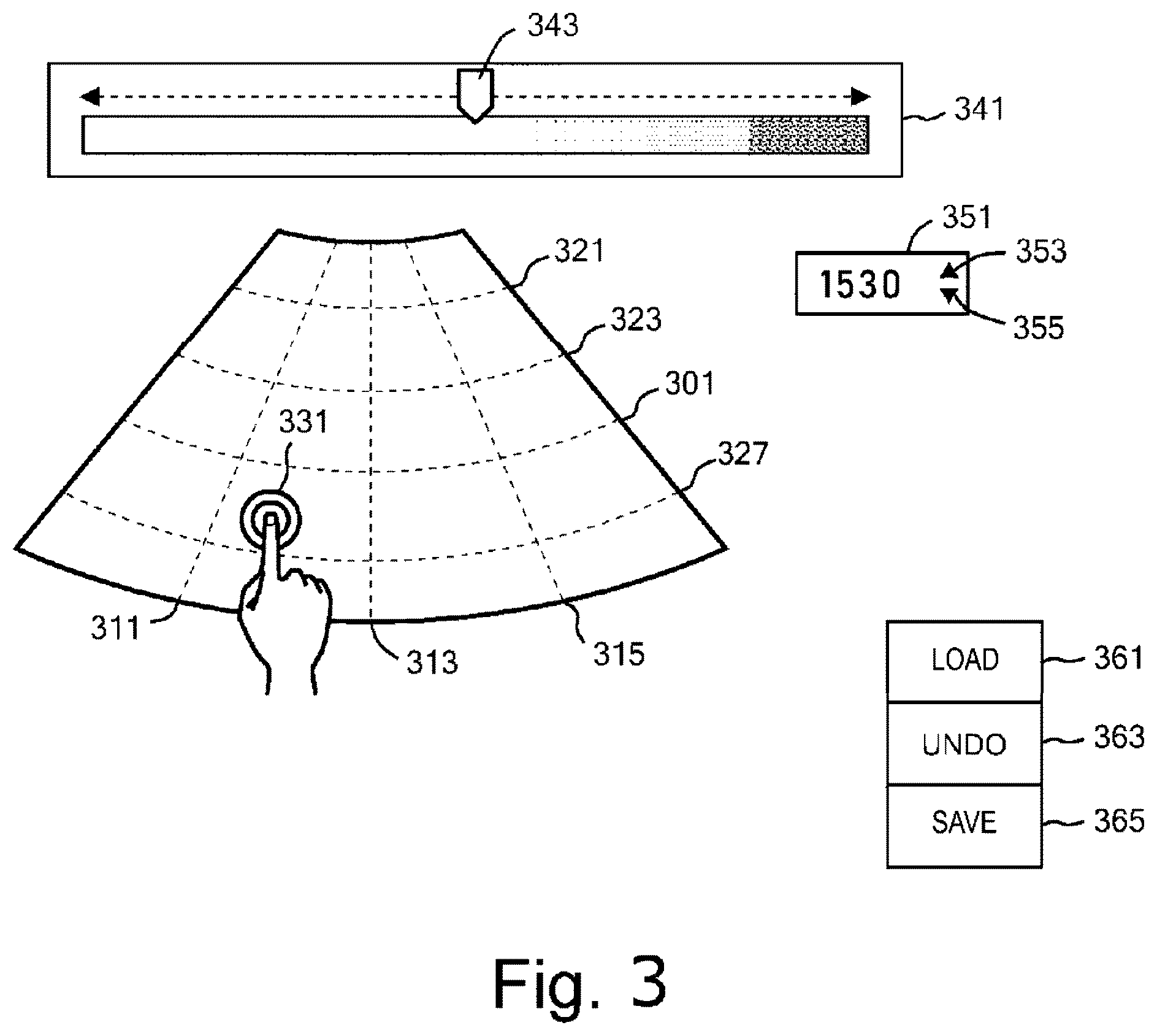 Patent US12611170 Figure 3 – Ultrasound diagnostic device capable of changing the sound speed in a local region