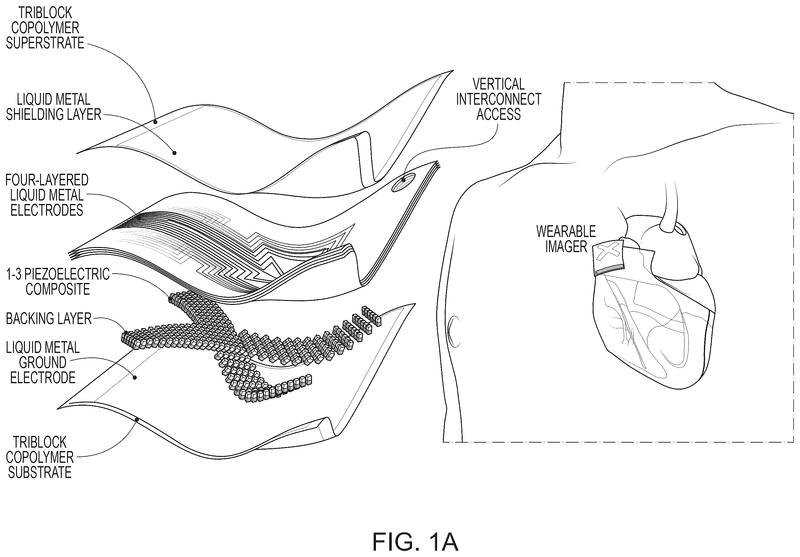 Patent US12611173 Figure 1 – Wearable ultrasound imaging device for imaging the heart and other internal tissue