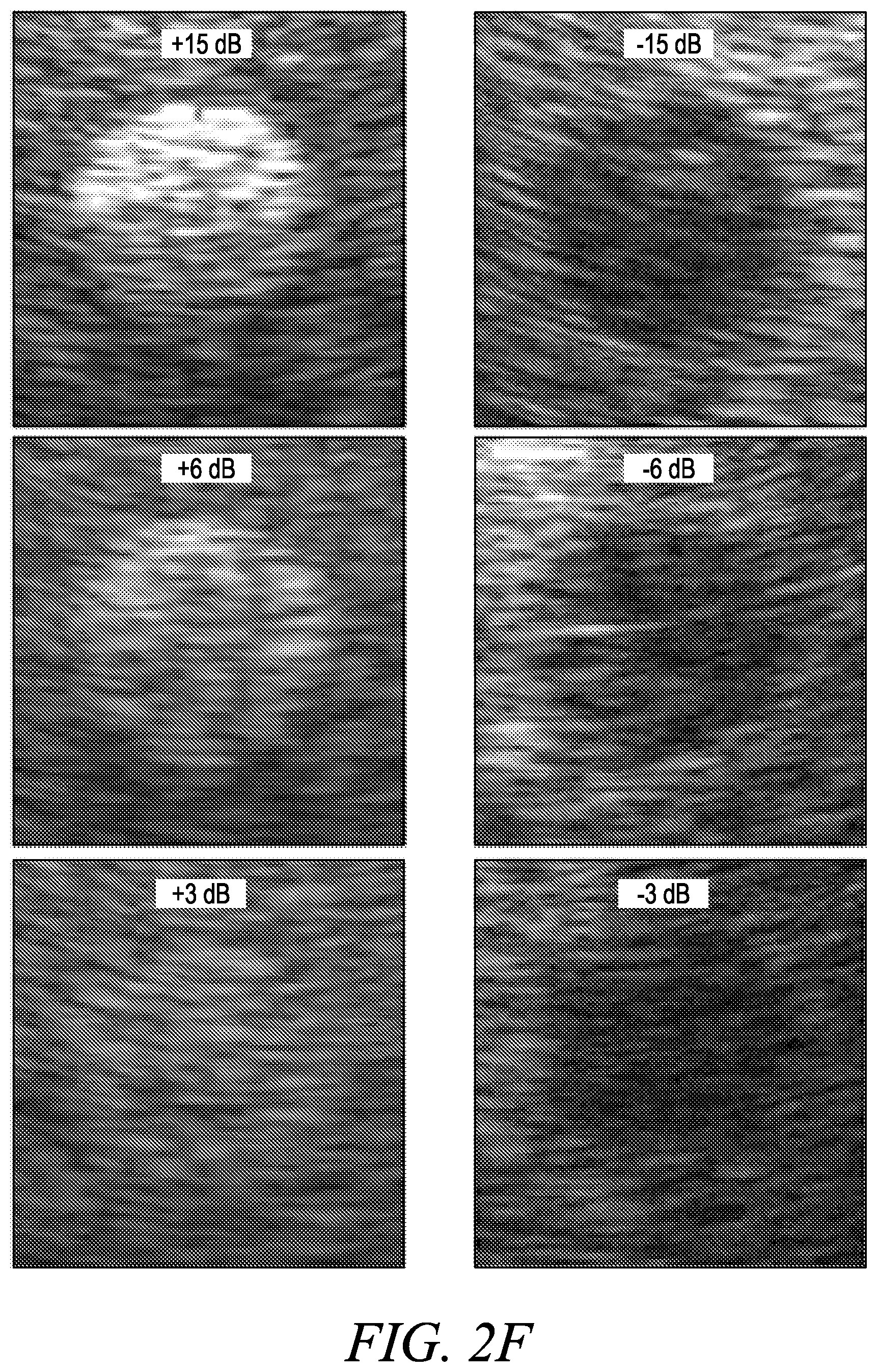 Patent US12611173 Figure 8 – Wearable ultrasound imaging device for imaging the heart and other internal tissue