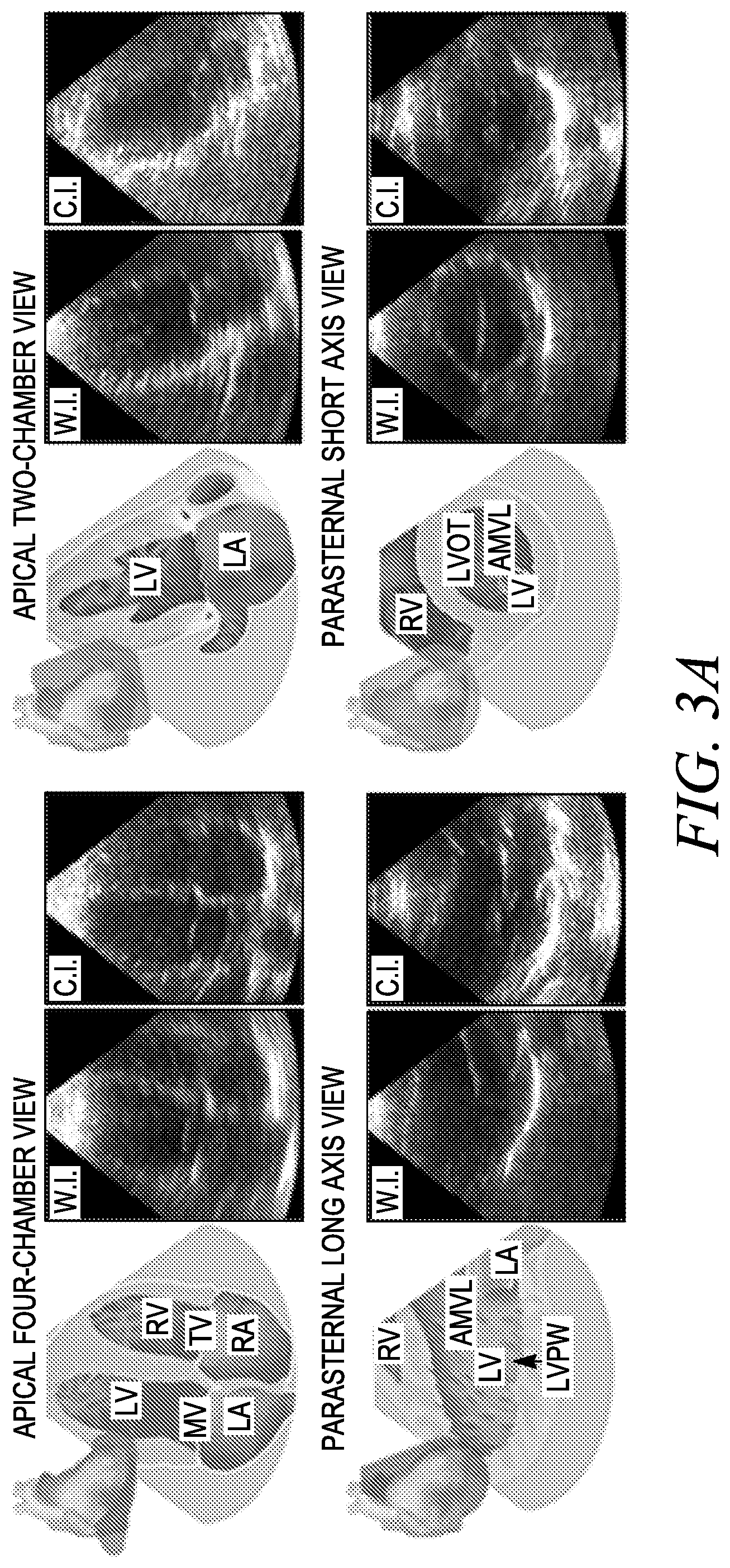 Patent US12611173 Figure 10 – Wearable ultrasound imaging device for imaging the heart and other internal tissue