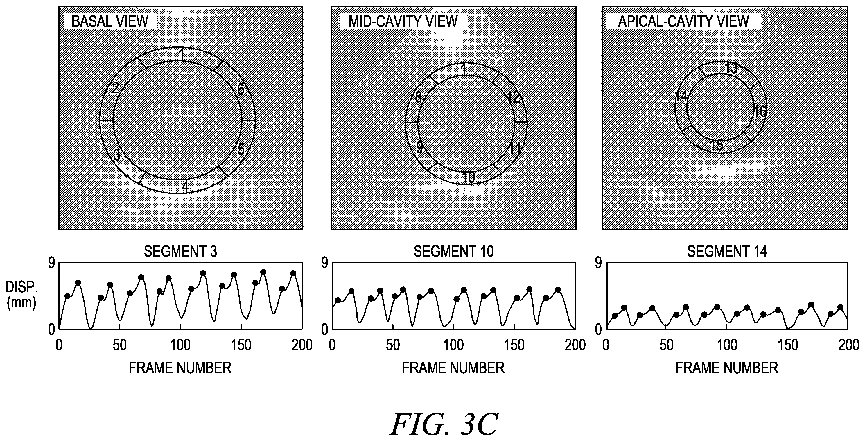 Patent US12611173 Figure 12 – Wearable ultrasound imaging device for imaging the heart and other internal tissue