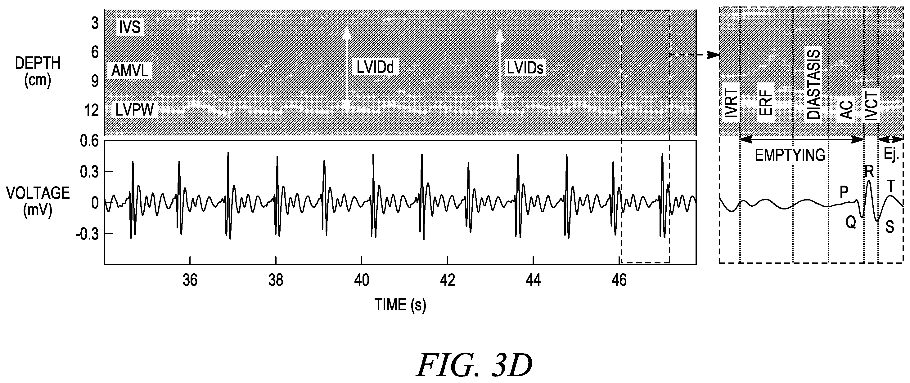 Patent US12611173 Figure 13 – Wearable ultrasound imaging device for imaging the heart and other internal tissue