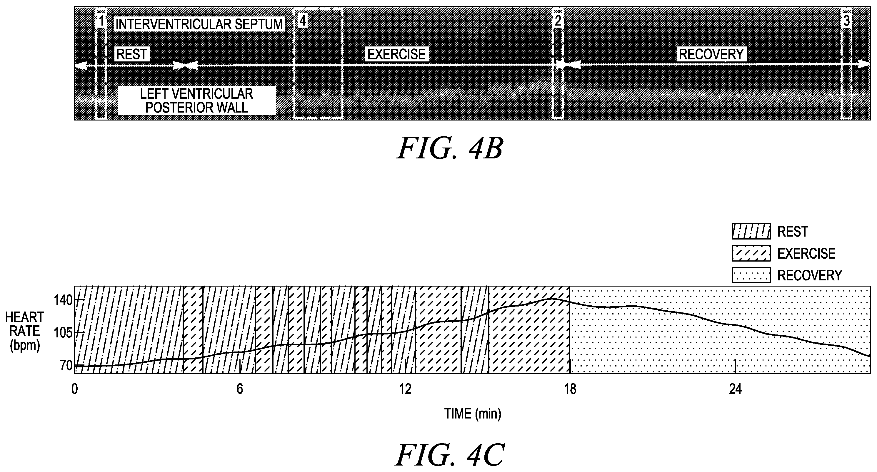 Patent US12611173 Figure 15 – Wearable ultrasound imaging device for imaging the heart and other internal tissue