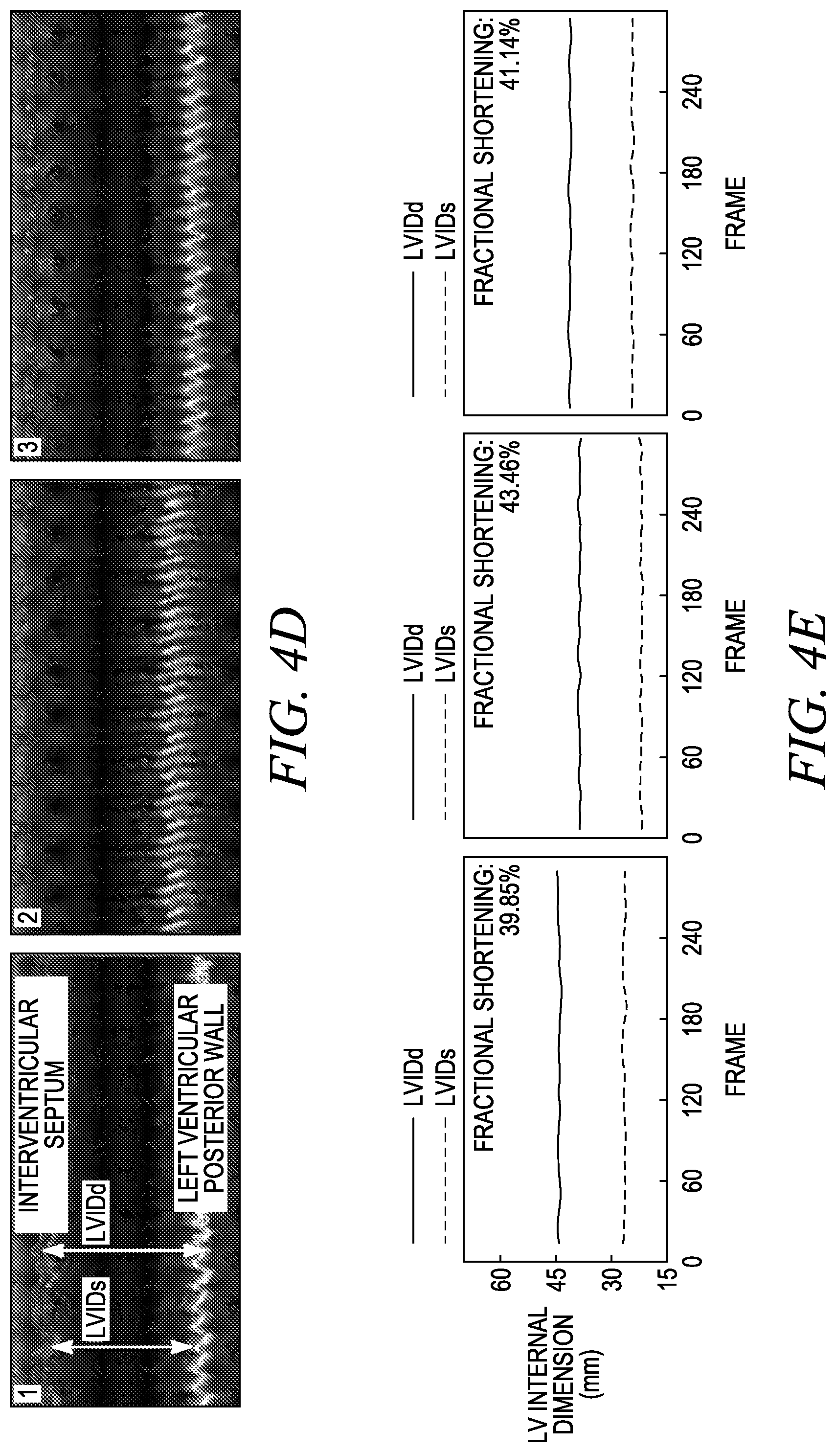Patent US12611173 Figure 16 – Wearable ultrasound imaging device for imaging the heart and other internal tissue