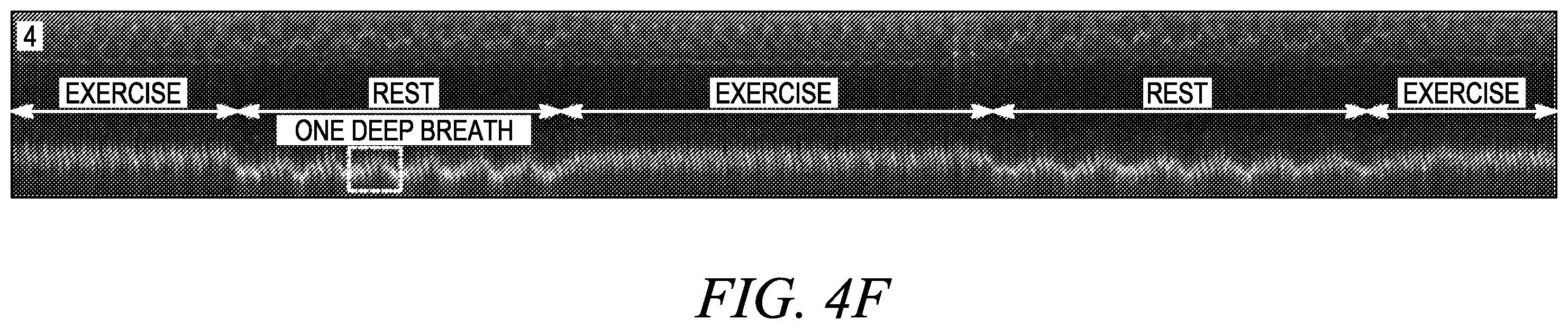 Patent US12611173 Figure 17 – Wearable ultrasound imaging device for imaging the heart and other internal tissue