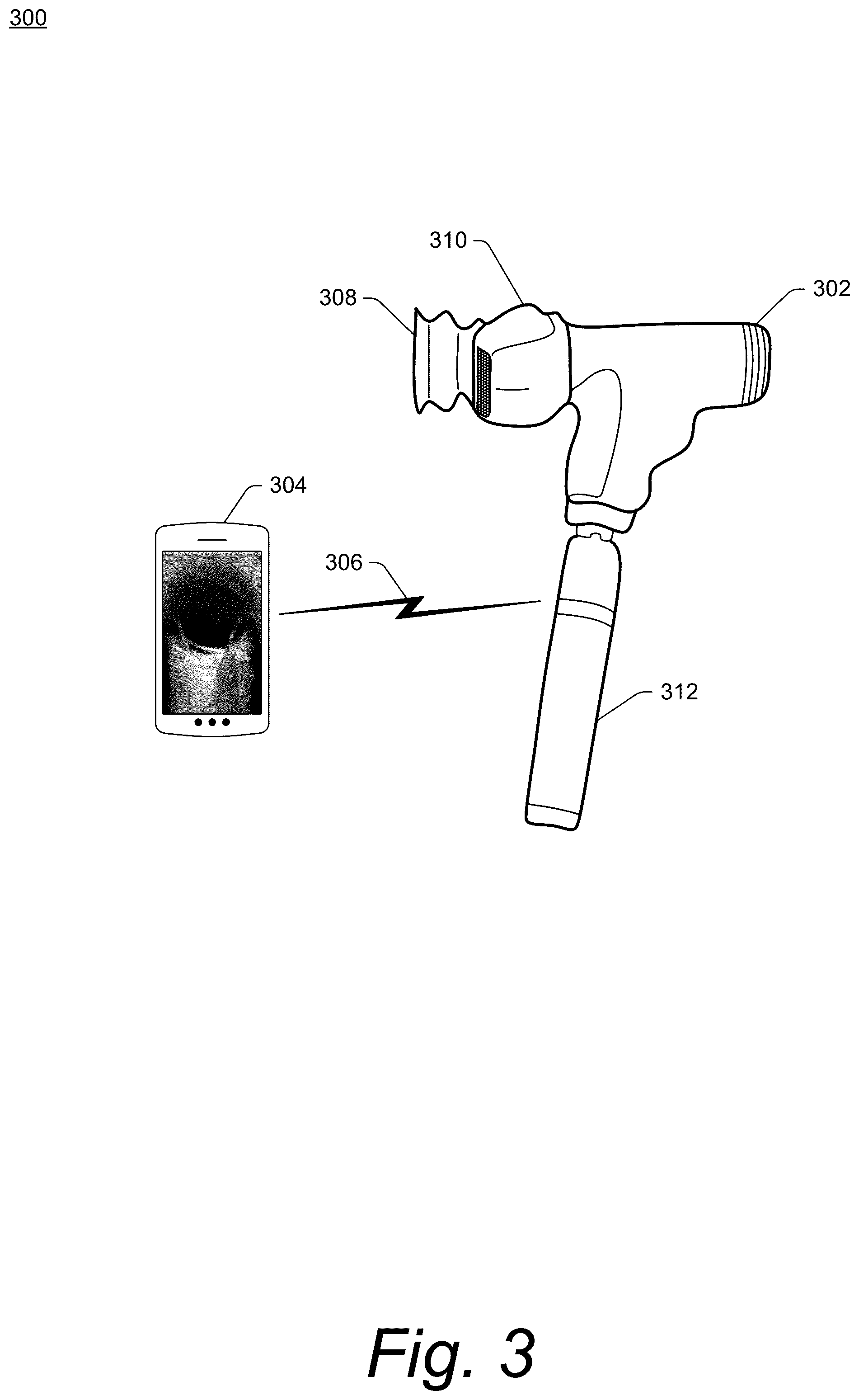 Patent US12611174 Figure 3 – Combination ocular ultrasound and ophthalmoscope