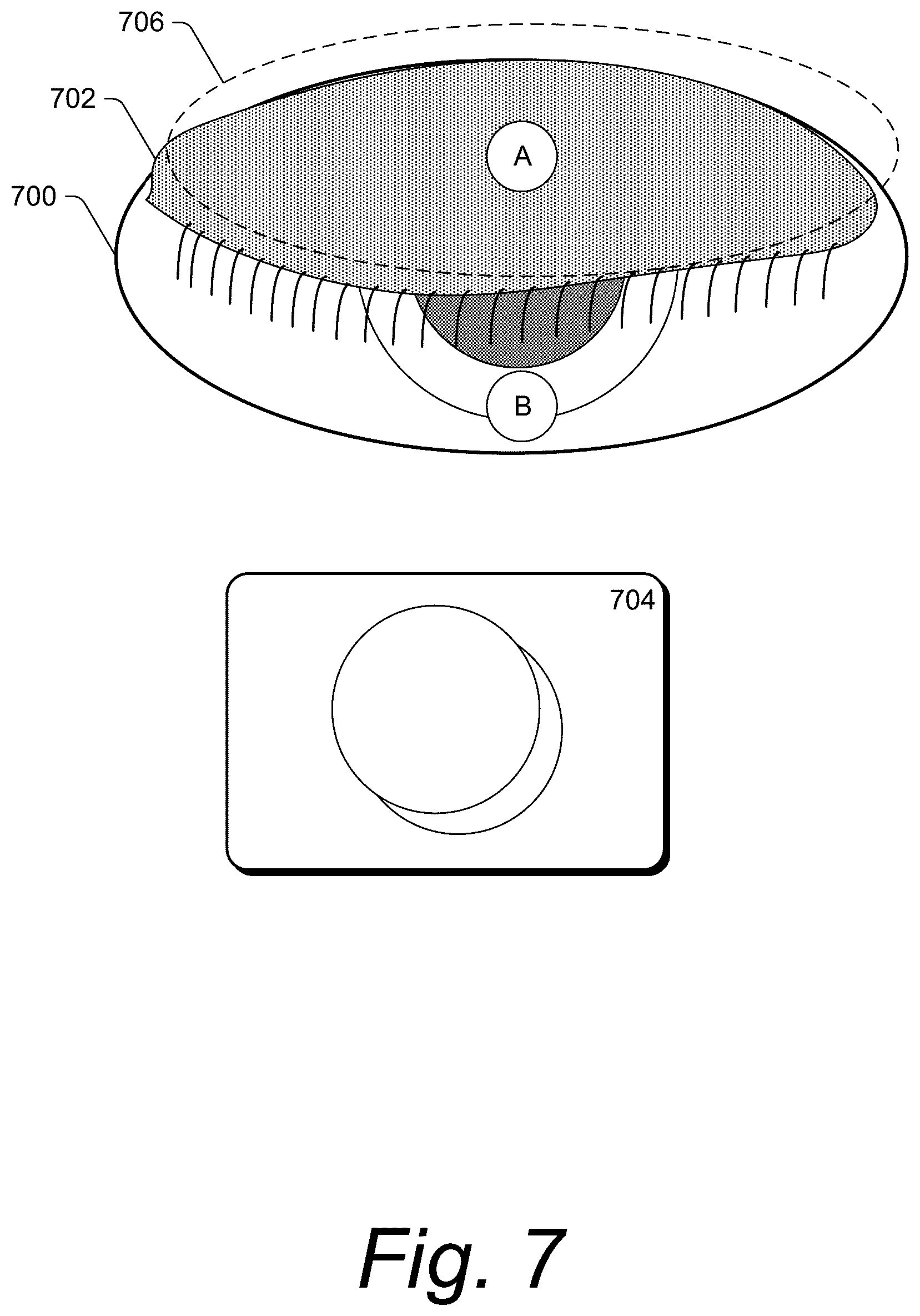 Patent US12611174 Figure 7 – Combination ocular ultrasound and ophthalmoscope