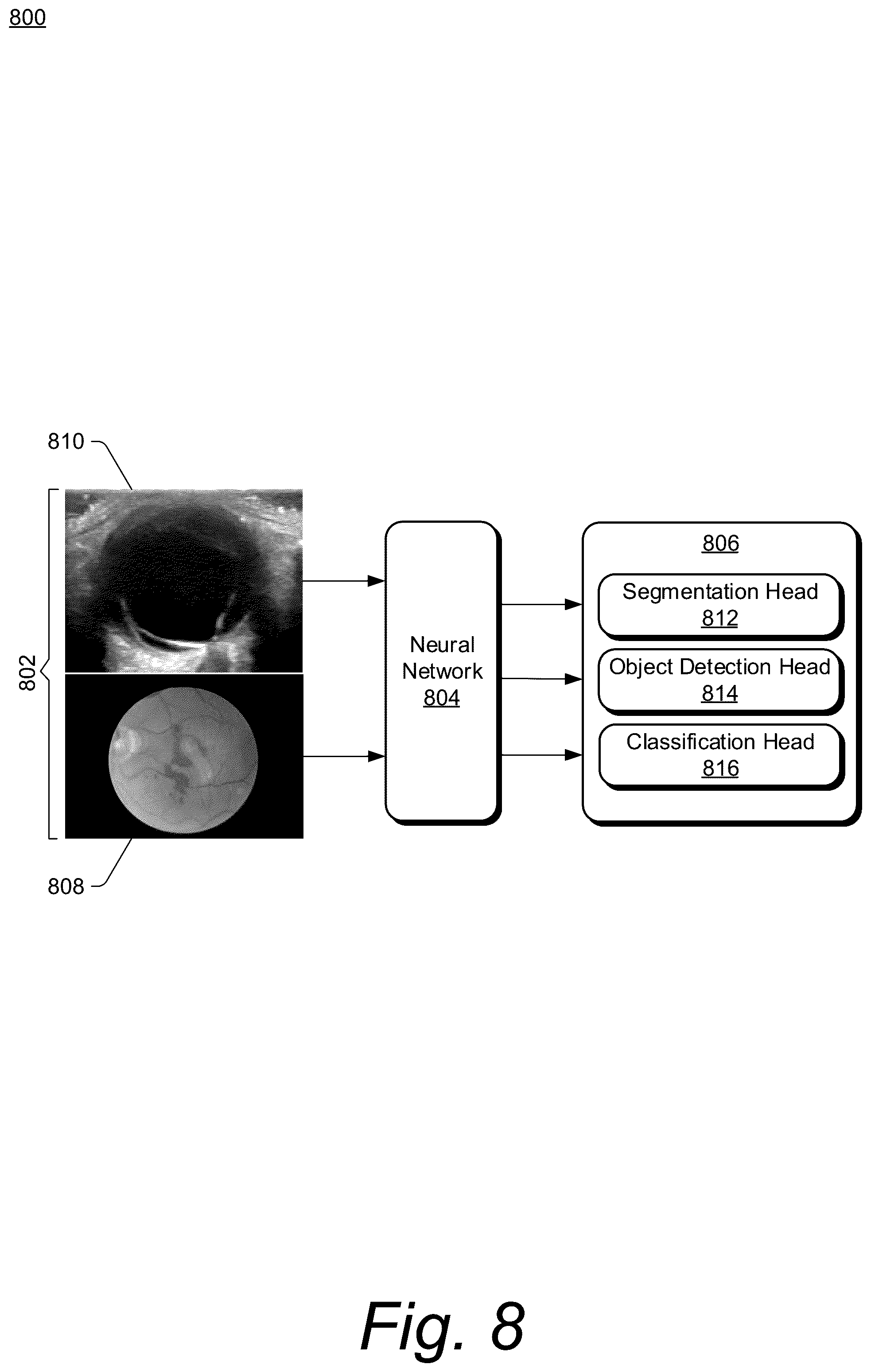 Patent US12611174 Figure 8 – Combination ocular ultrasound and ophthalmoscope