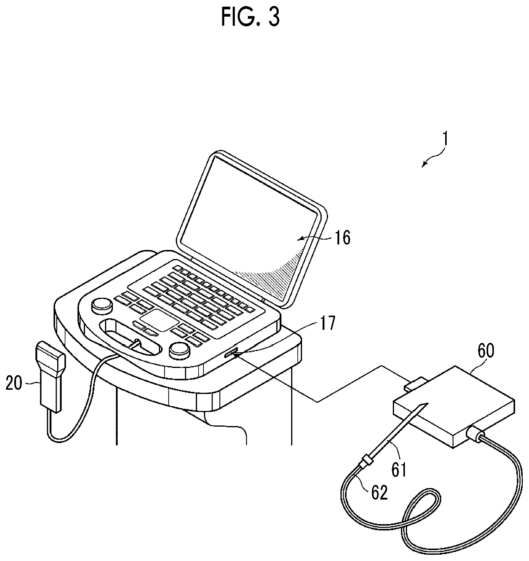 Patent US12611175 Figure 3 – Ultrasound diagnostic apparatus