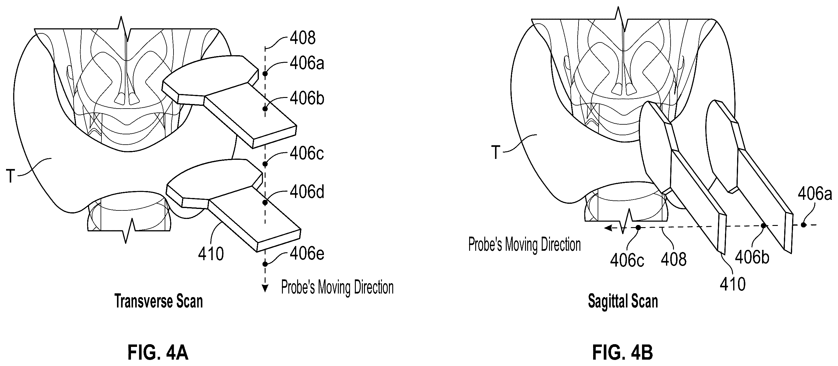 Patent US12611180 Figure 4 – Method and system for cross-referencing of two-dimensional (2D) ultrasound scans of a tissue volume