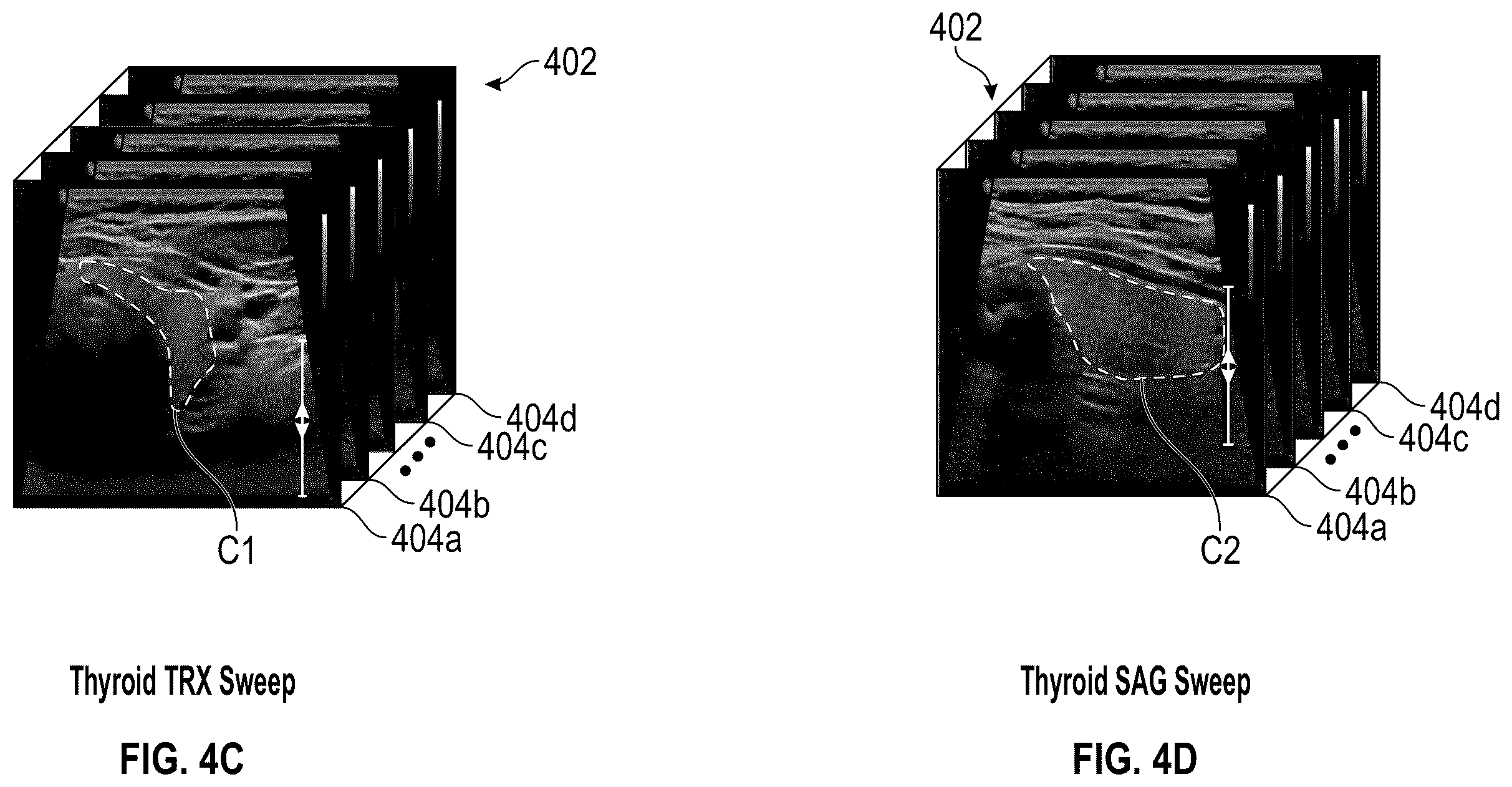 Patent US12611180 Figure 5 – Method and system for cross-referencing of two-dimensional (2D) ultrasound scans of a tissue volume