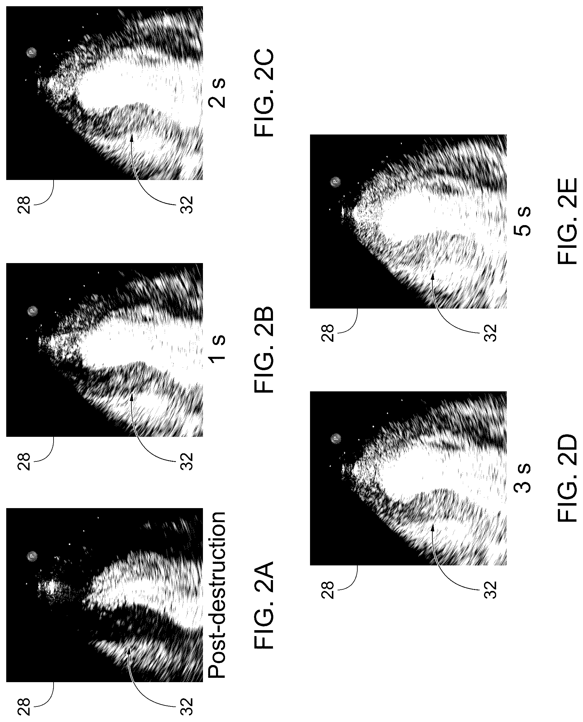 Patent US12611181 Figure 2 – Methods for displaying replenishment time data using myocardial contrast echocardiography and related systems