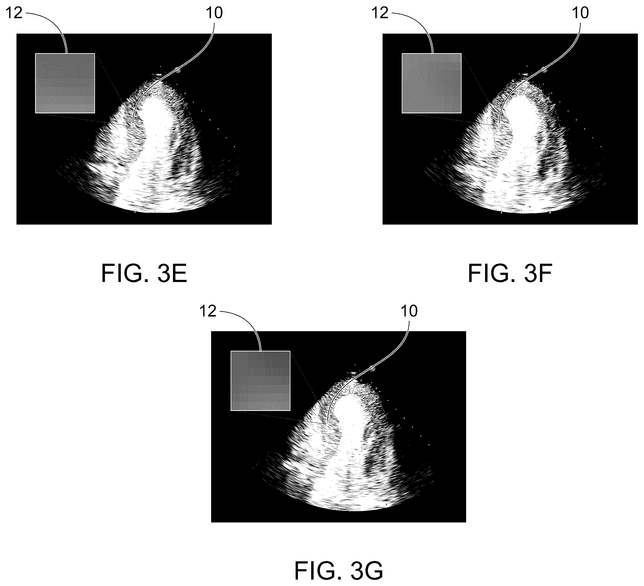 Patent US12611181 Figure 4 – Methods for displaying replenishment time data using myocardial contrast echocardiography and related systems