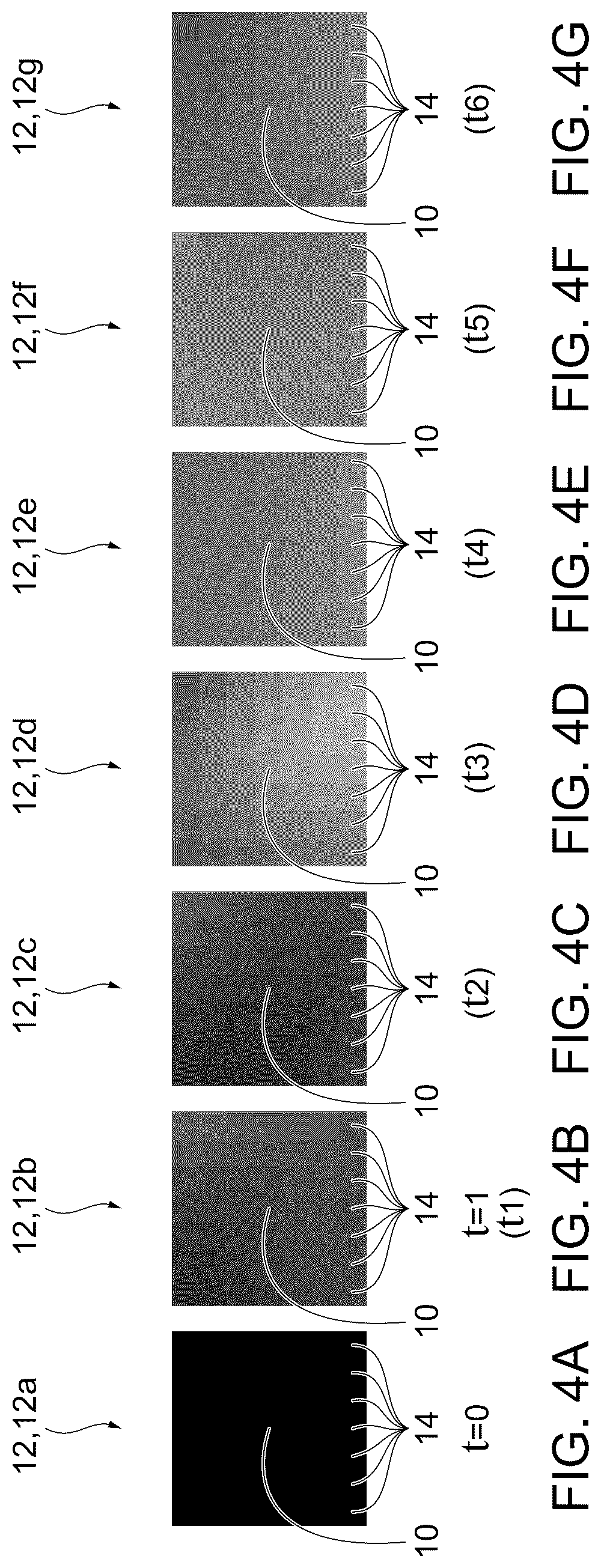 Patent US12611181 Figure 5 – Methods for displaying replenishment time data using myocardial contrast echocardiography and related systems