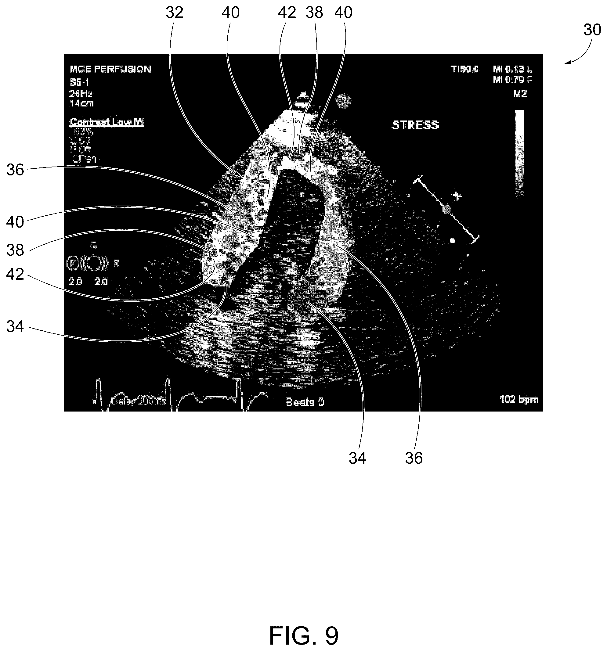 Patent US12611181 Figure 8 – Methods for displaying replenishment time data using myocardial contrast echocardiography and related systems