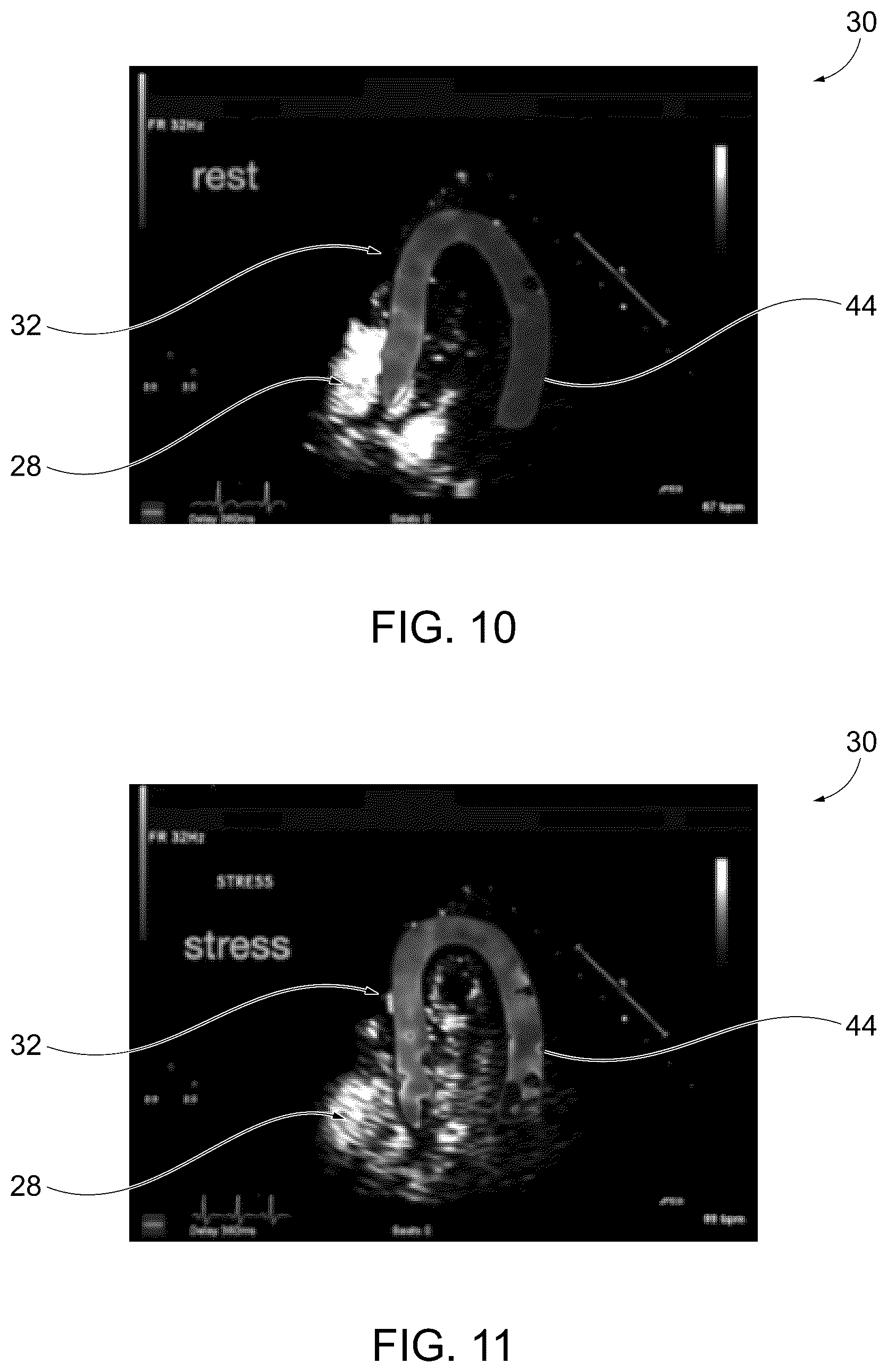 Patent US12611181 Figure 9 – Methods for displaying replenishment time data using myocardial contrast echocardiography and related systems