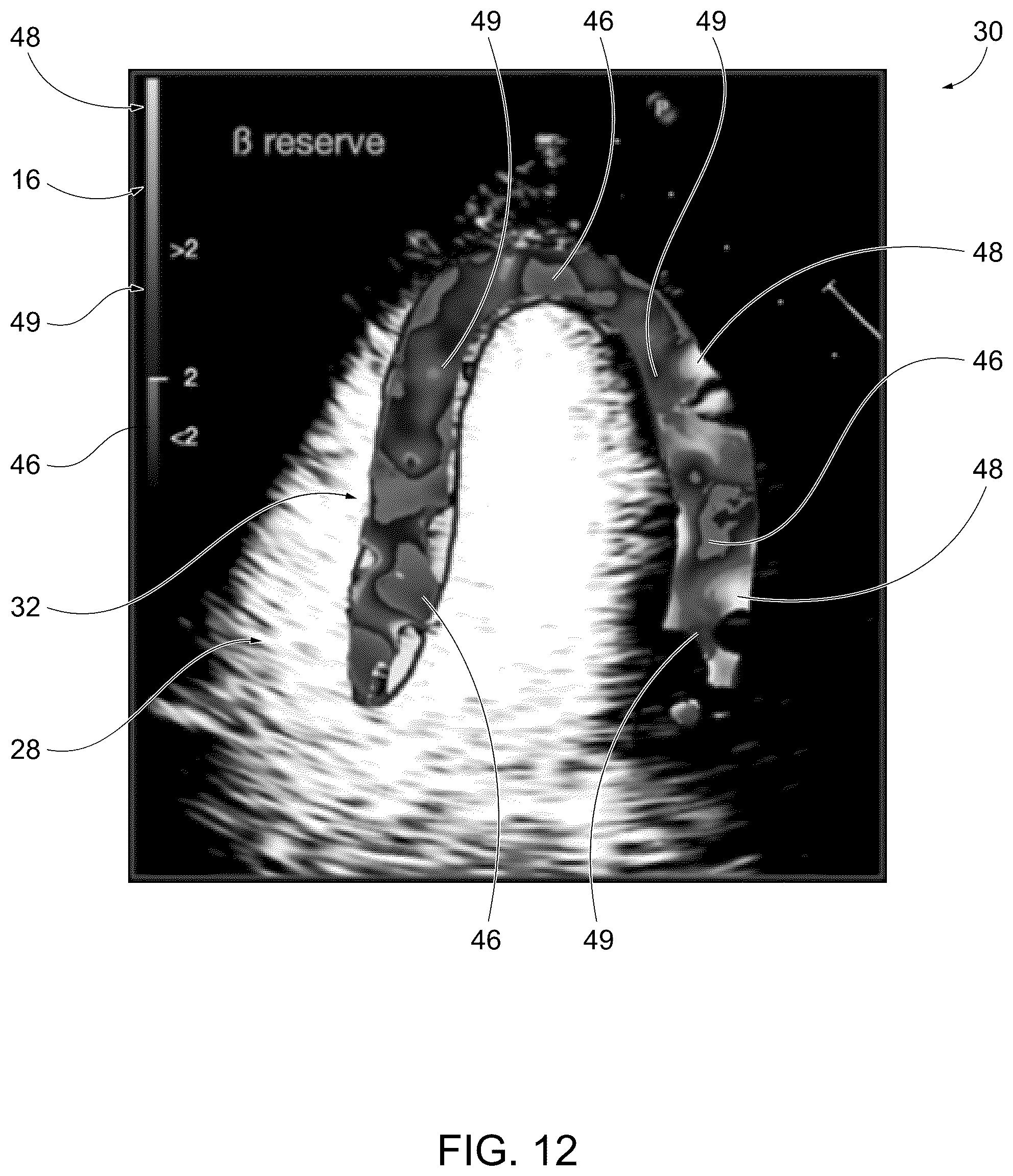 Patent US12611181 Figure 10 – Methods for displaying replenishment time data using myocardial contrast echocardiography and related systems