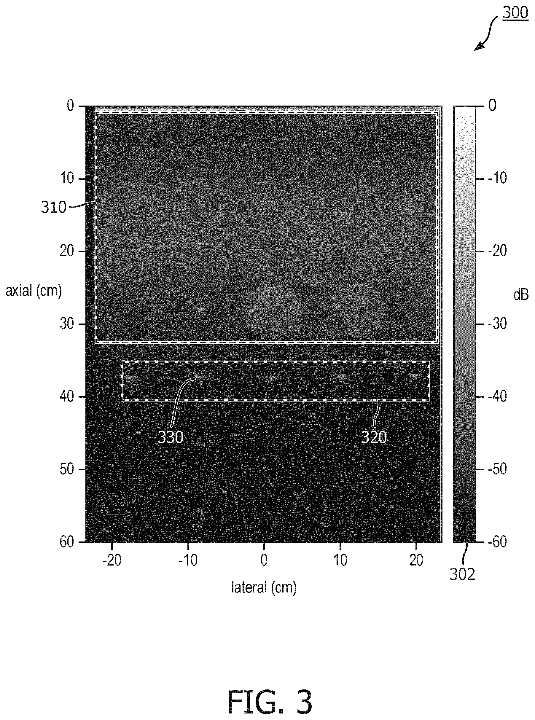 Patent US12611182 Figure 3 – Coherently compounded ultrasound image generation and associated systems, methods, and devices