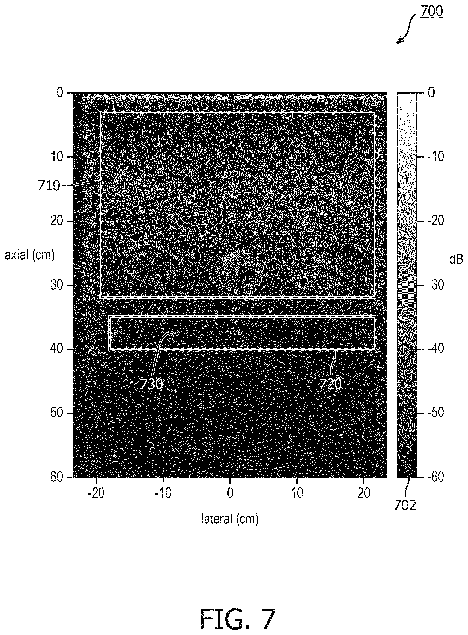 Patent US12611182 Figure 7 – Coherently compounded ultrasound image generation and associated systems, methods, and devices