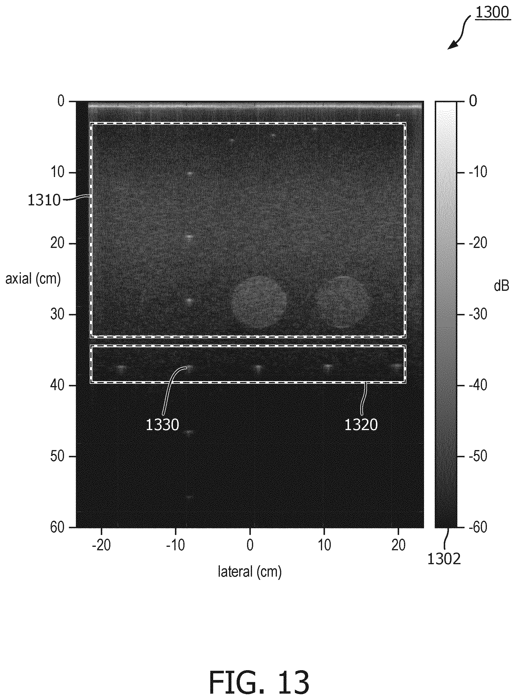 Patent US12611182 Figure 13 – Coherently compounded ultrasound image generation and associated systems, methods, and devices