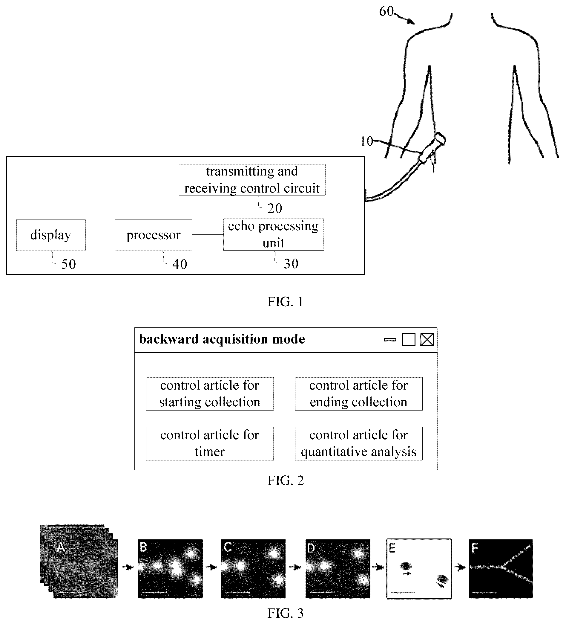 Patent US12611183 Figure 1 – Contrast enhanced imaging method and ultrasonic imaging system