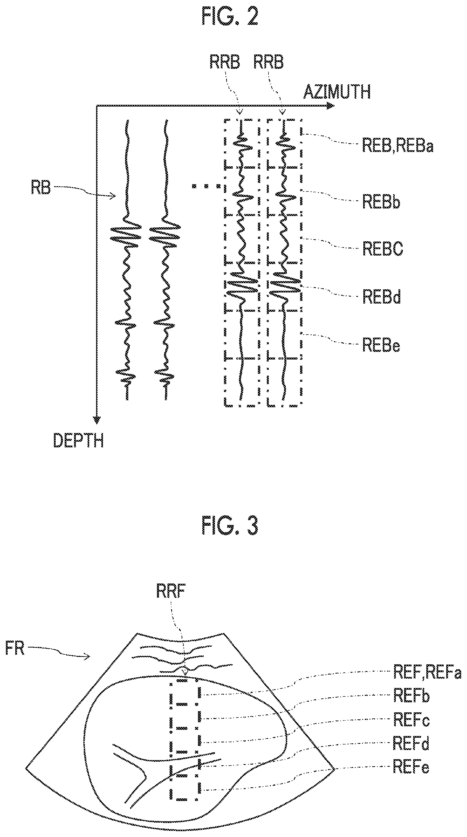 Patent US12611187 Figure 2 – Ultrasound diagnostic apparatus for reducing influences of structure and speckle in subject