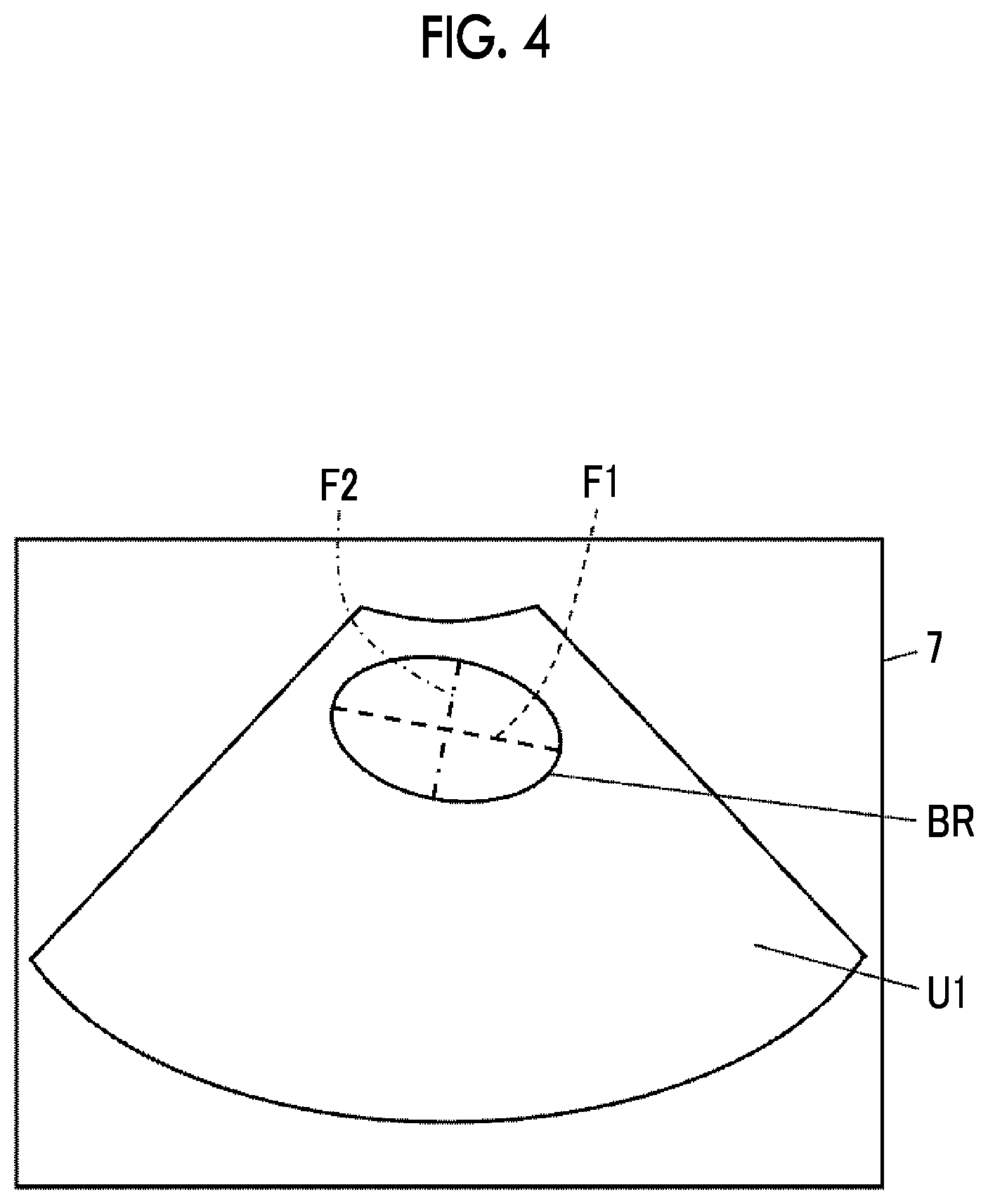 Patent US12611190 Figure 3 – Ultrasound diagnostic apparatus and control method of ultrasound diagnostic apparatus for measuring a volume of a bladder of a subject