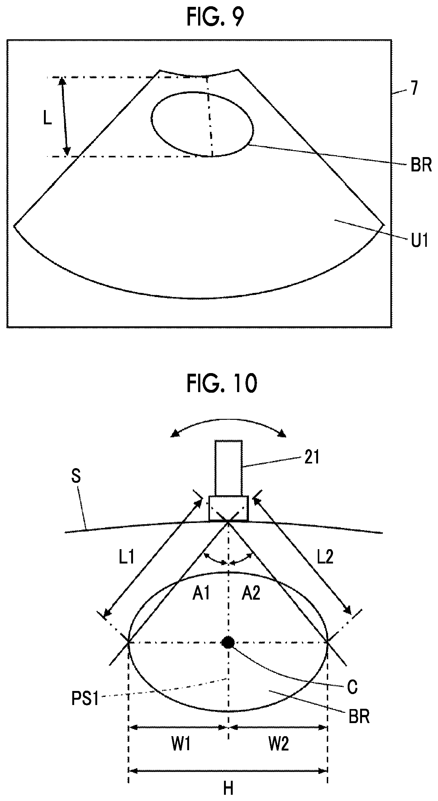 Patent US12611190 Figure 7 – Ultrasound diagnostic apparatus and control method of ultrasound diagnostic apparatus for measuring a volume of a bladder of a subject