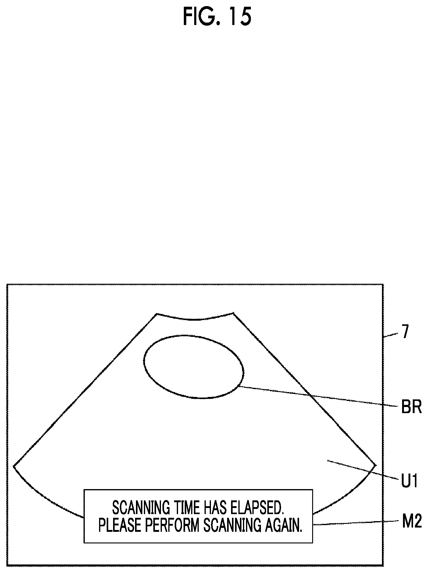 Patent US12611190 Figure 12 – Ultrasound diagnostic apparatus and control method of ultrasound diagnostic apparatus for measuring a volume of a bladder of a subject