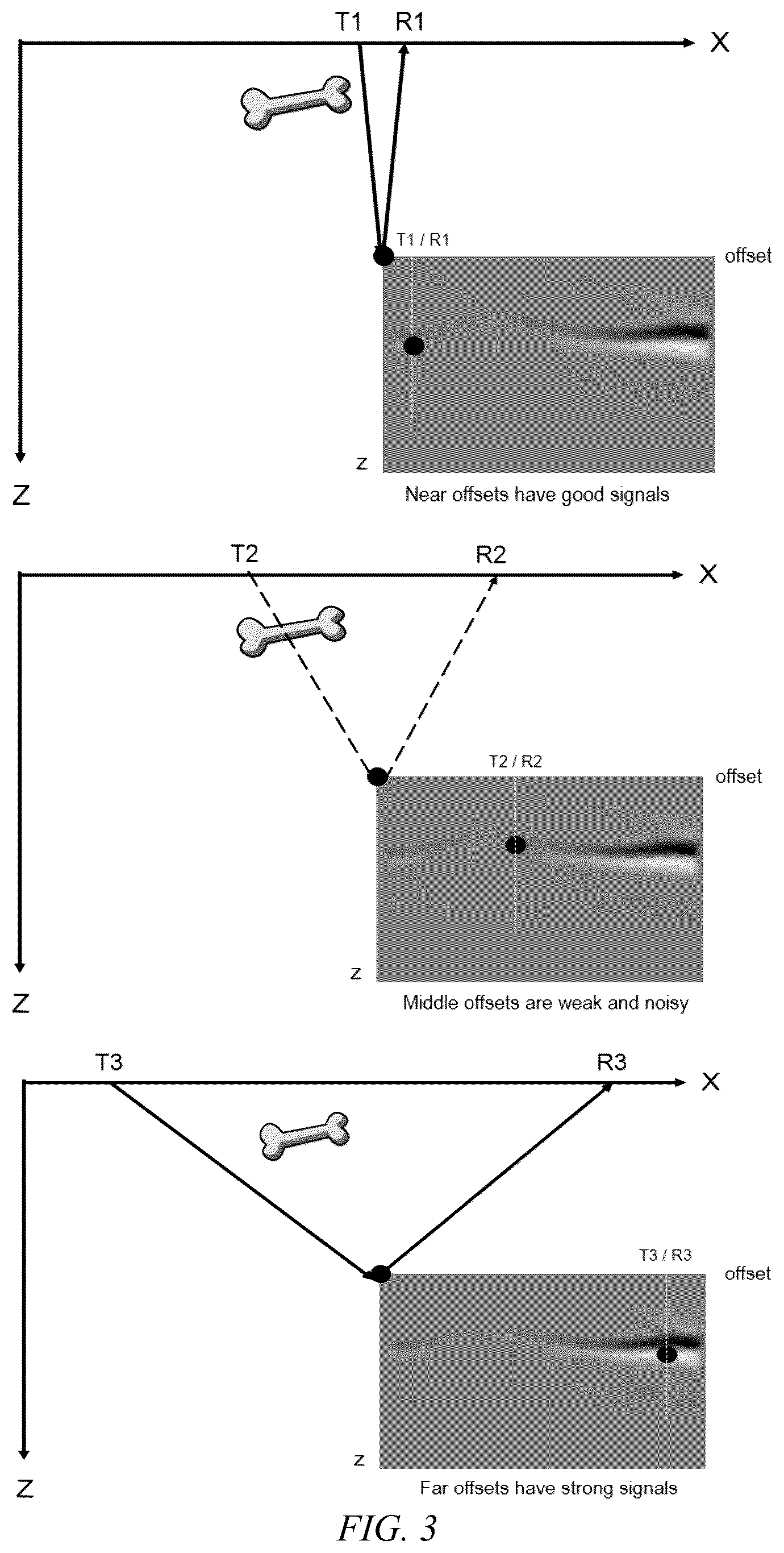 Patent US12611193 Figure 3 – Imaging tissues and organs behind obstacles using an ultrasound array transducer
