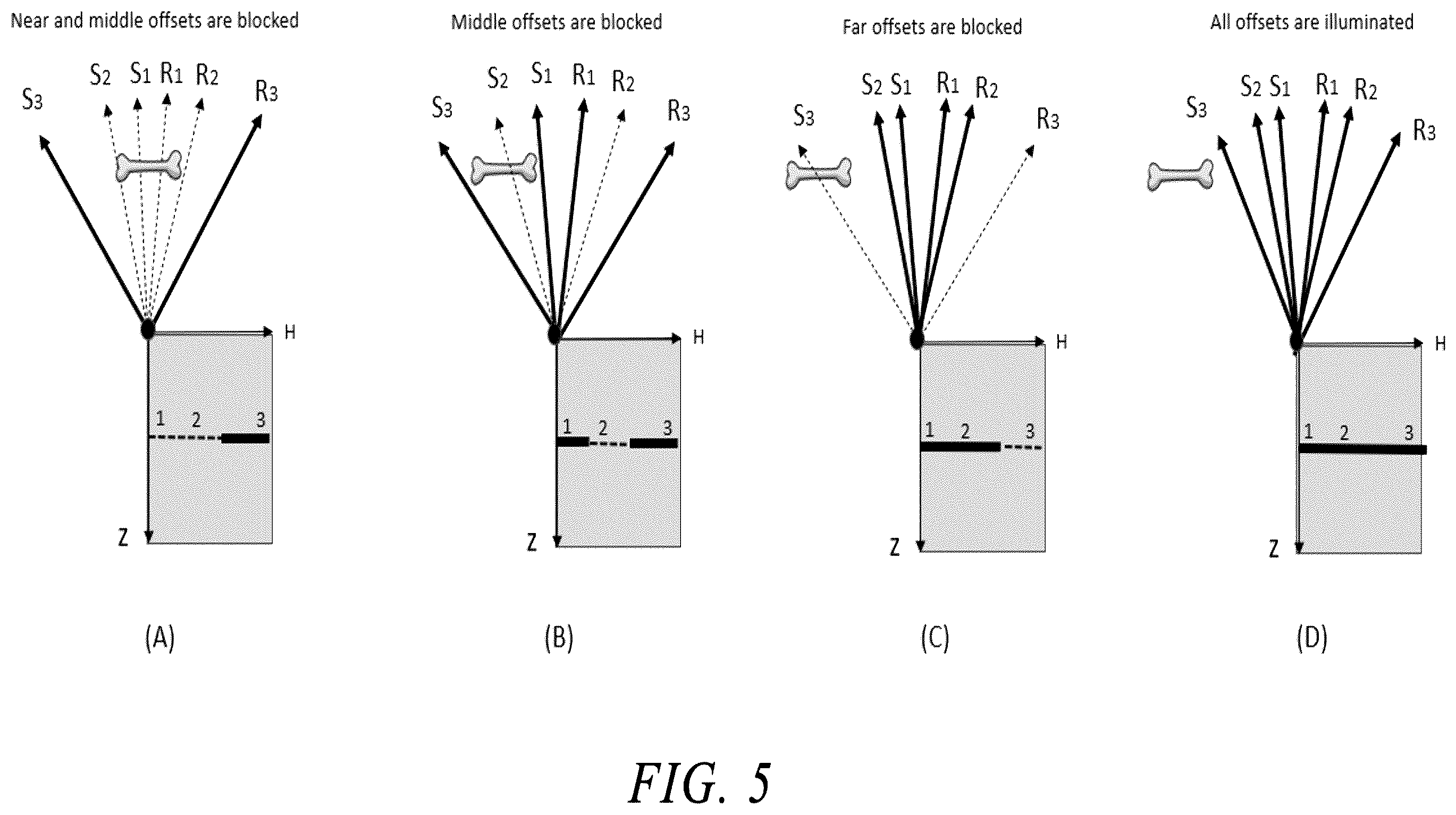 Patent US12611193 Figure 5 – Imaging tissues and organs behind obstacles using an ultrasound array transducer