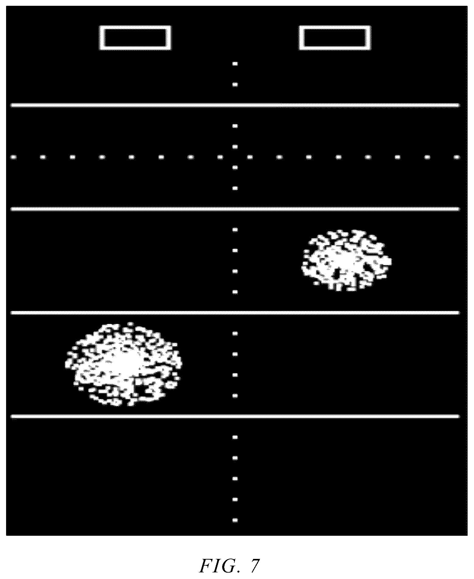 Patent US12611193 Figure 7 – Imaging tissues and organs behind obstacles using an ultrasound array transducer