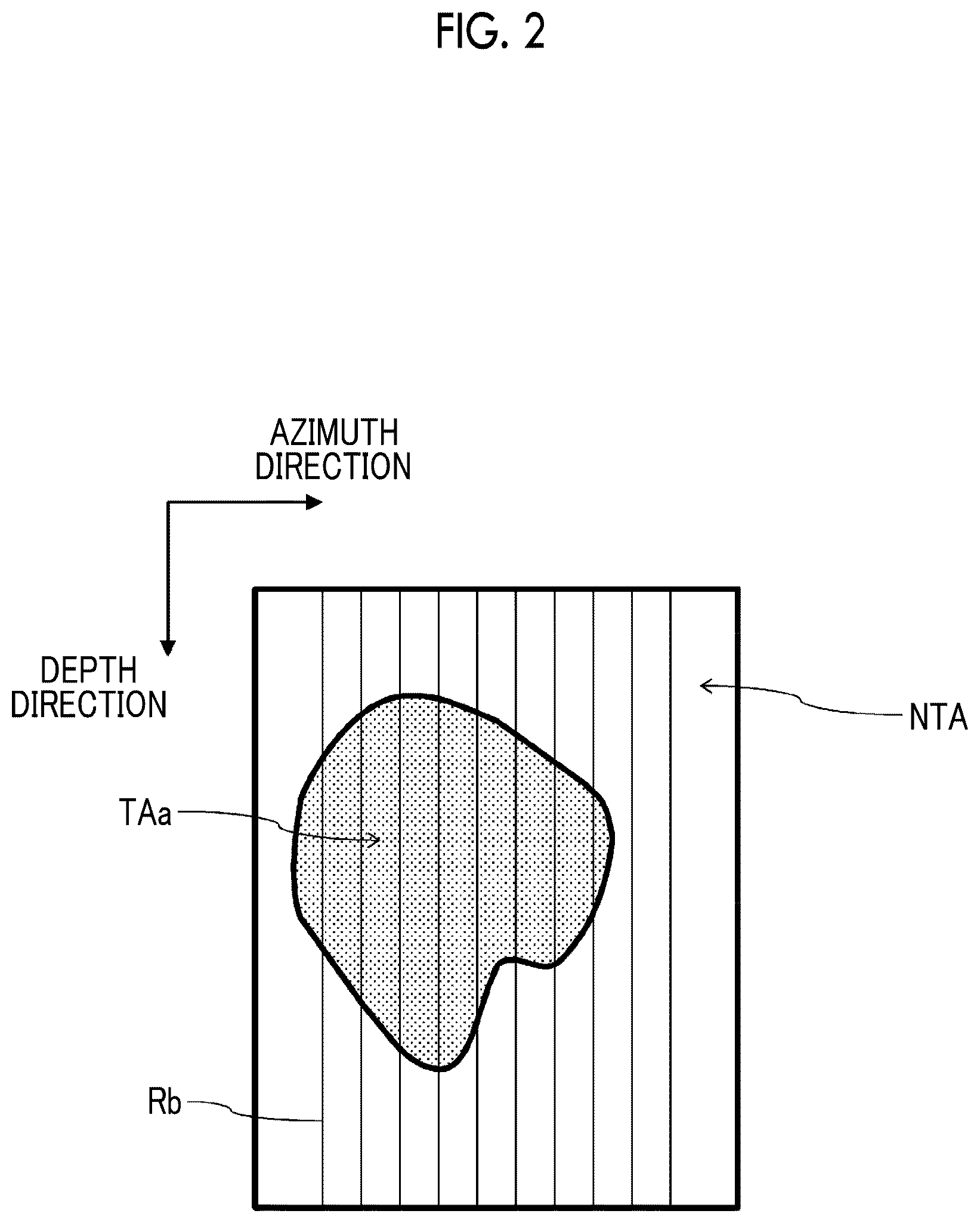 Patent US12611194 Figure 2 – Ultrasound diagnostic apparatus forming ultrasound image based on RF signals subjected to signal processing in consideration of target region