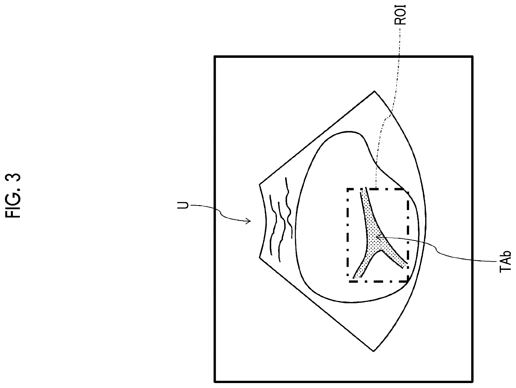 Patent US12611194 Figure 3 – Ultrasound diagnostic apparatus forming ultrasound image based on RF signals subjected to signal processing in consideration of target region