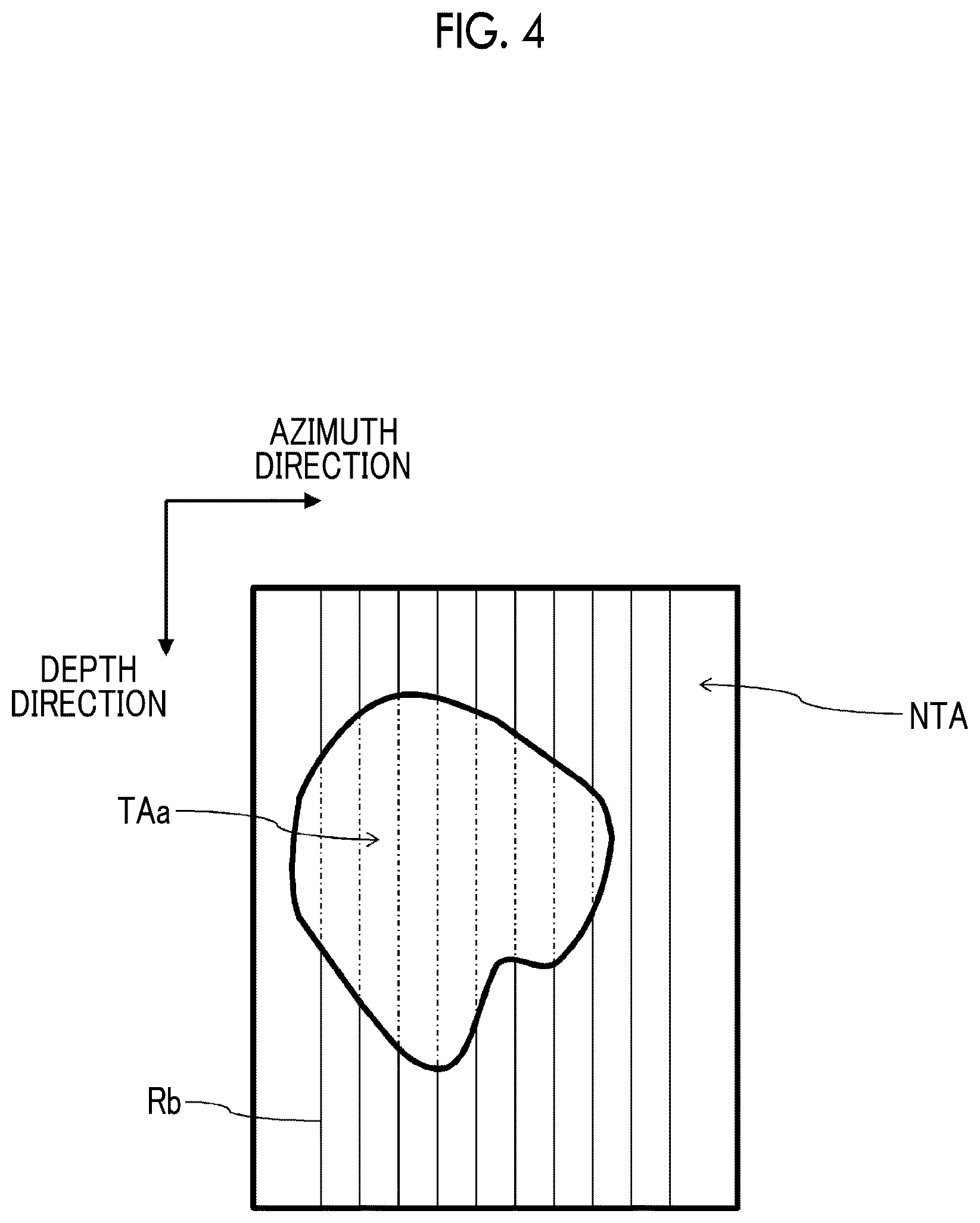Patent US12611194 Figure 4 – Ultrasound diagnostic apparatus forming ultrasound image based on RF signals subjected to signal processing in consideration of target region