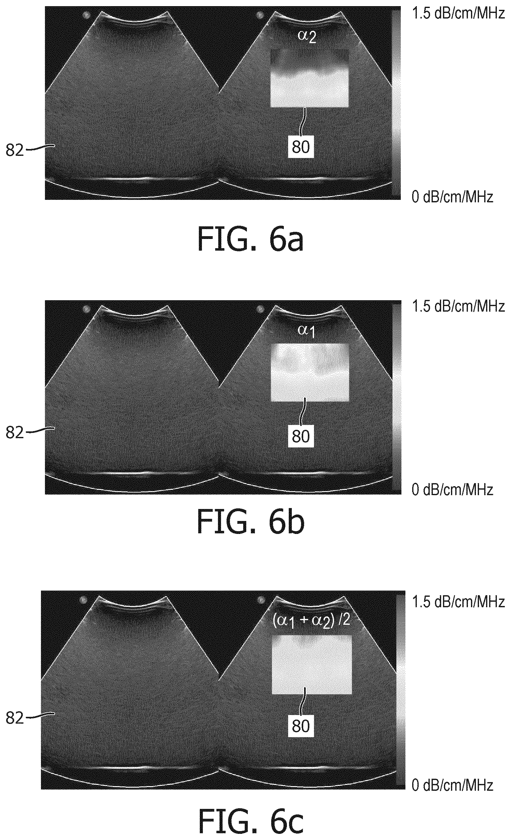 Patent US12611196 Figure 6 – Ultrasonic quantification of acoustic attenuation coefficient in the presence of elevation aperture blockage