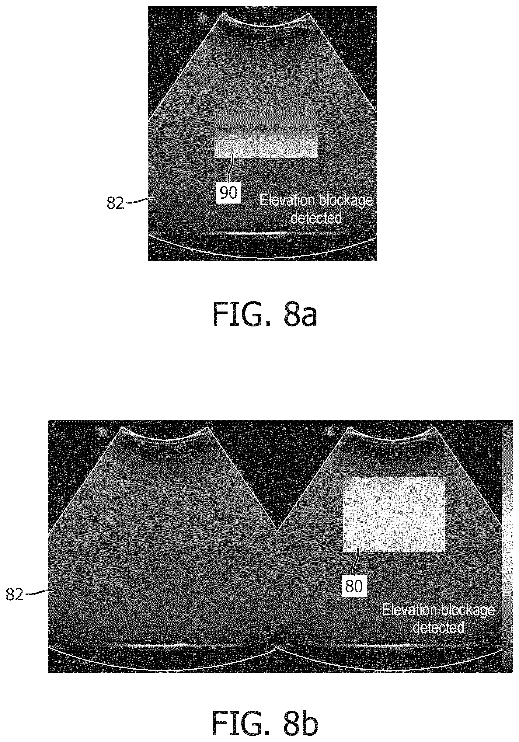 Patent US12611196 Figure 8 – Ultrasonic quantification of acoustic attenuation coefficient in the presence of elevation aperture blockage