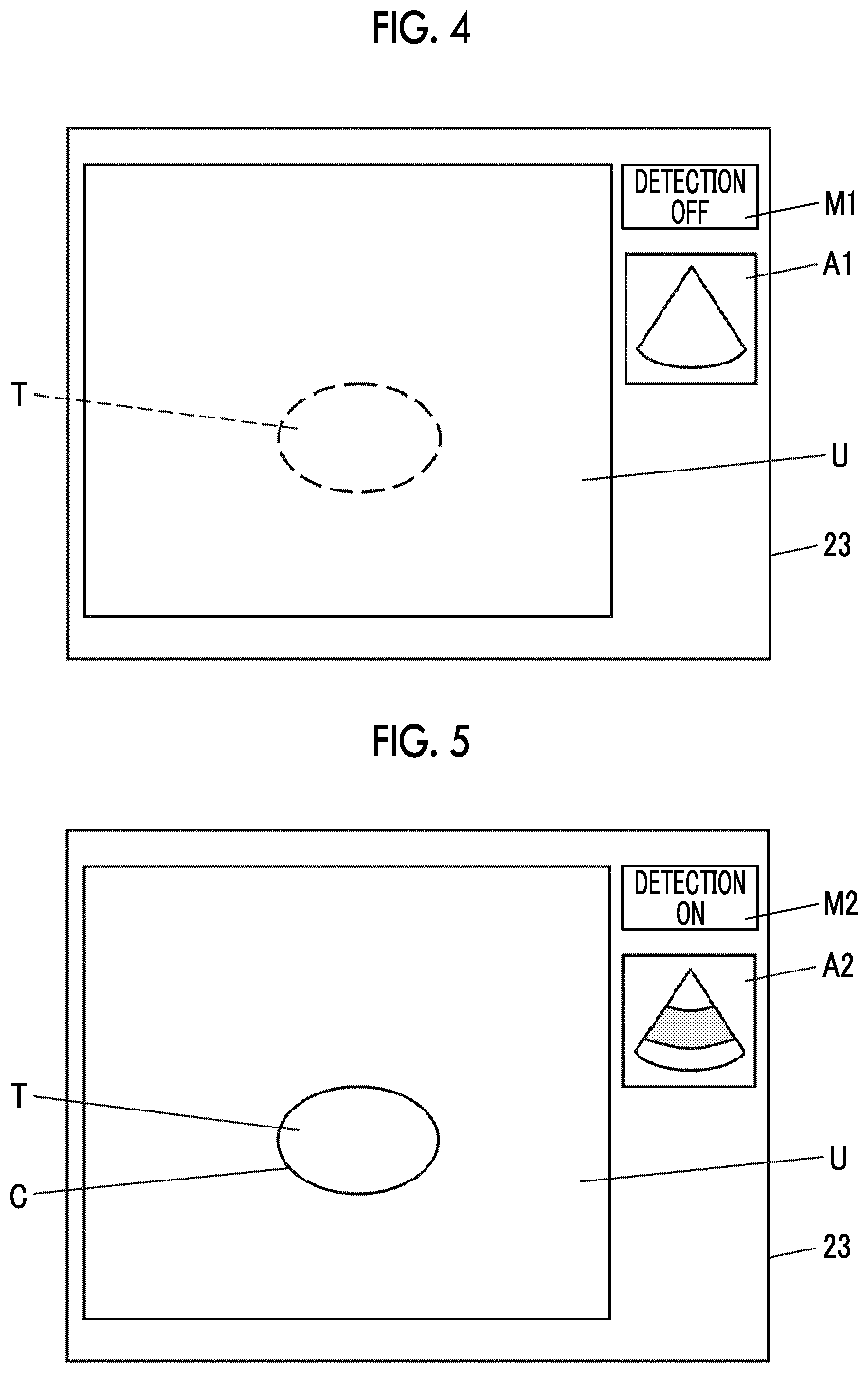 Patent US12611197 Figure 3 – Ultrasound diagnostic apparatus and control method of ultrasound diagnostic apparatus for detecting a specific target from an ultrasound image
