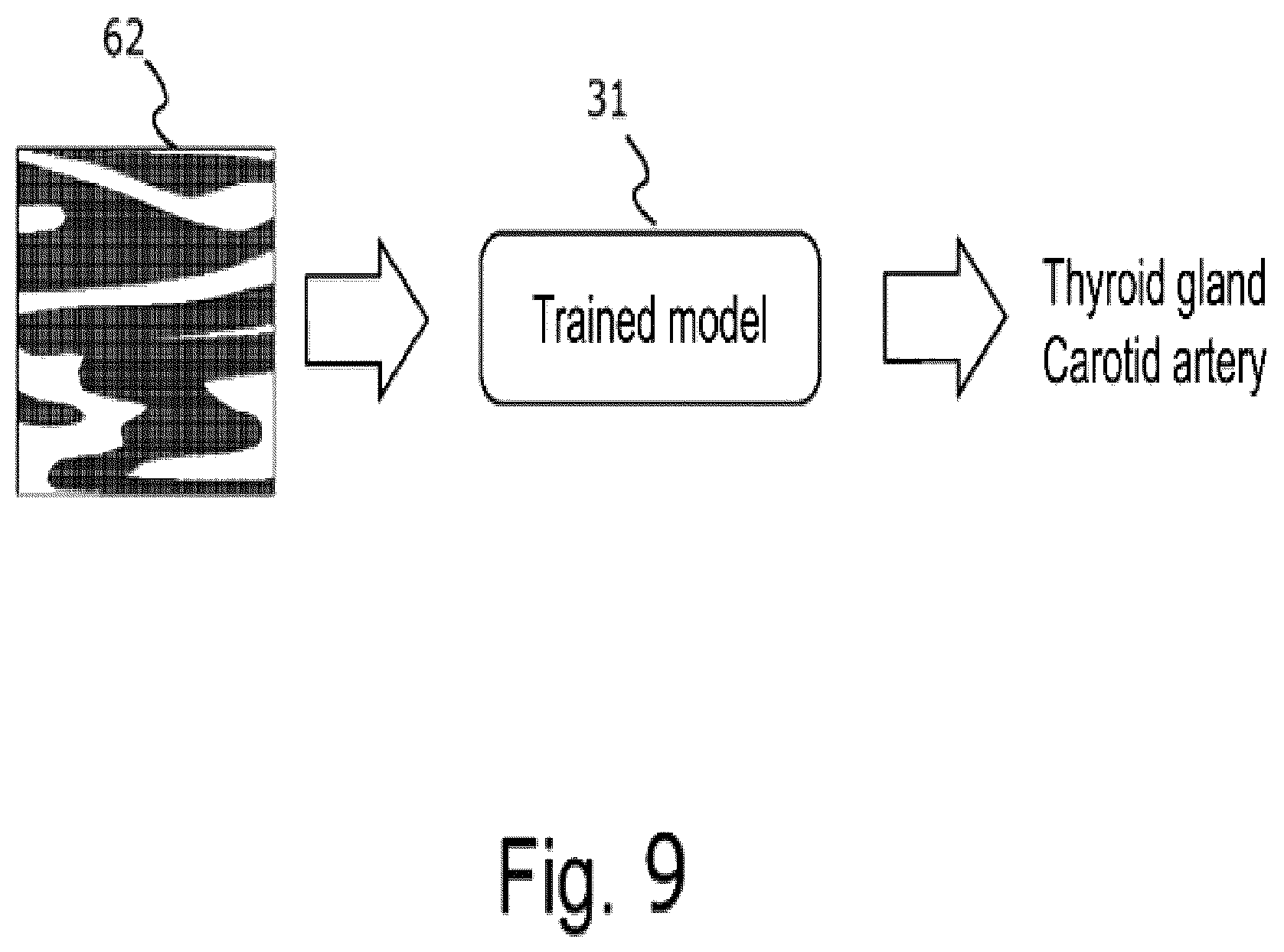 Patent US12611198 Figure 9 – Ultrasonic diagnostic device, storage medium, and method for changing imaging conditions