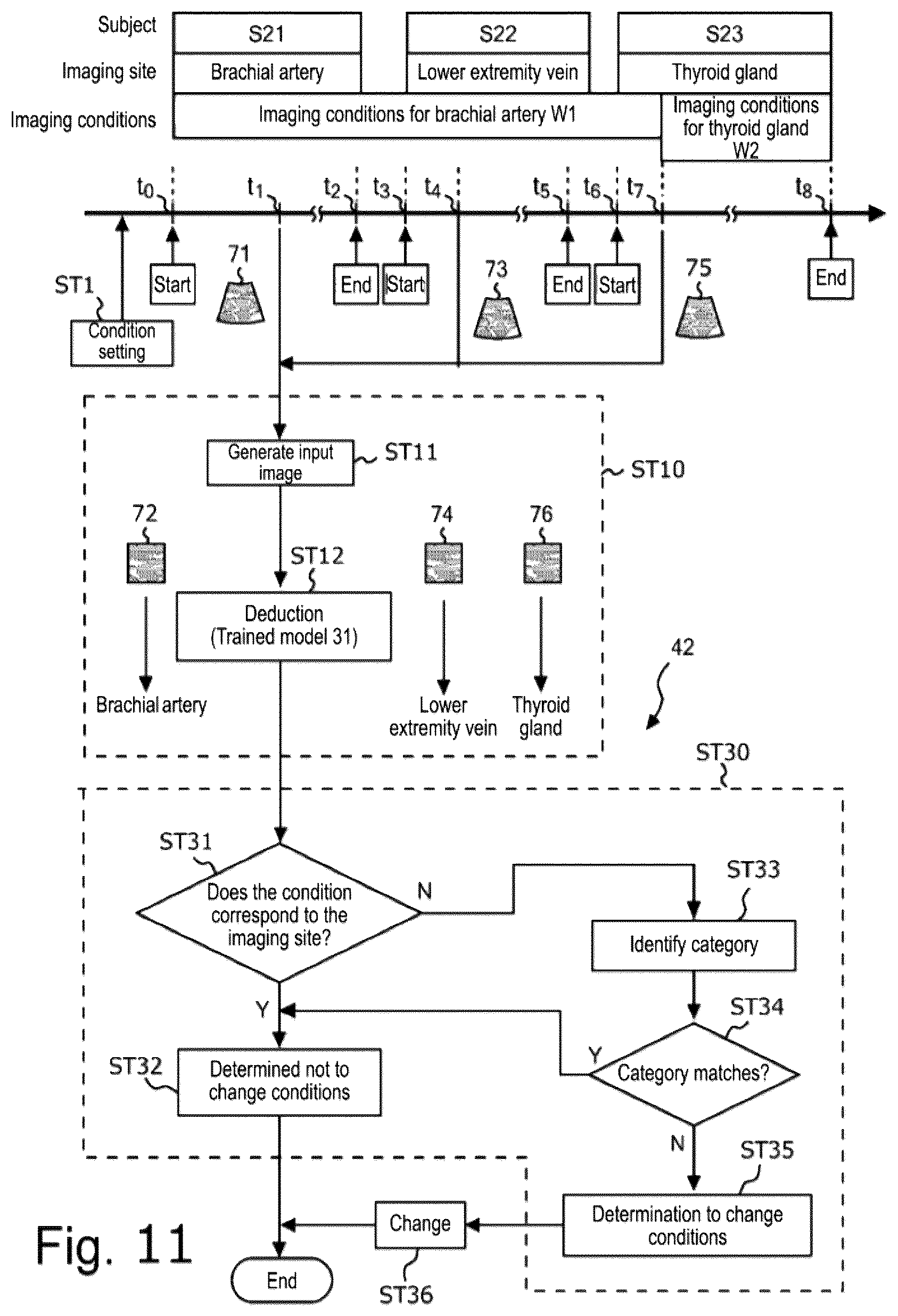 Patent US12611198 Figure 11 – Ultrasonic diagnostic device, storage medium, and method for changing imaging conditions