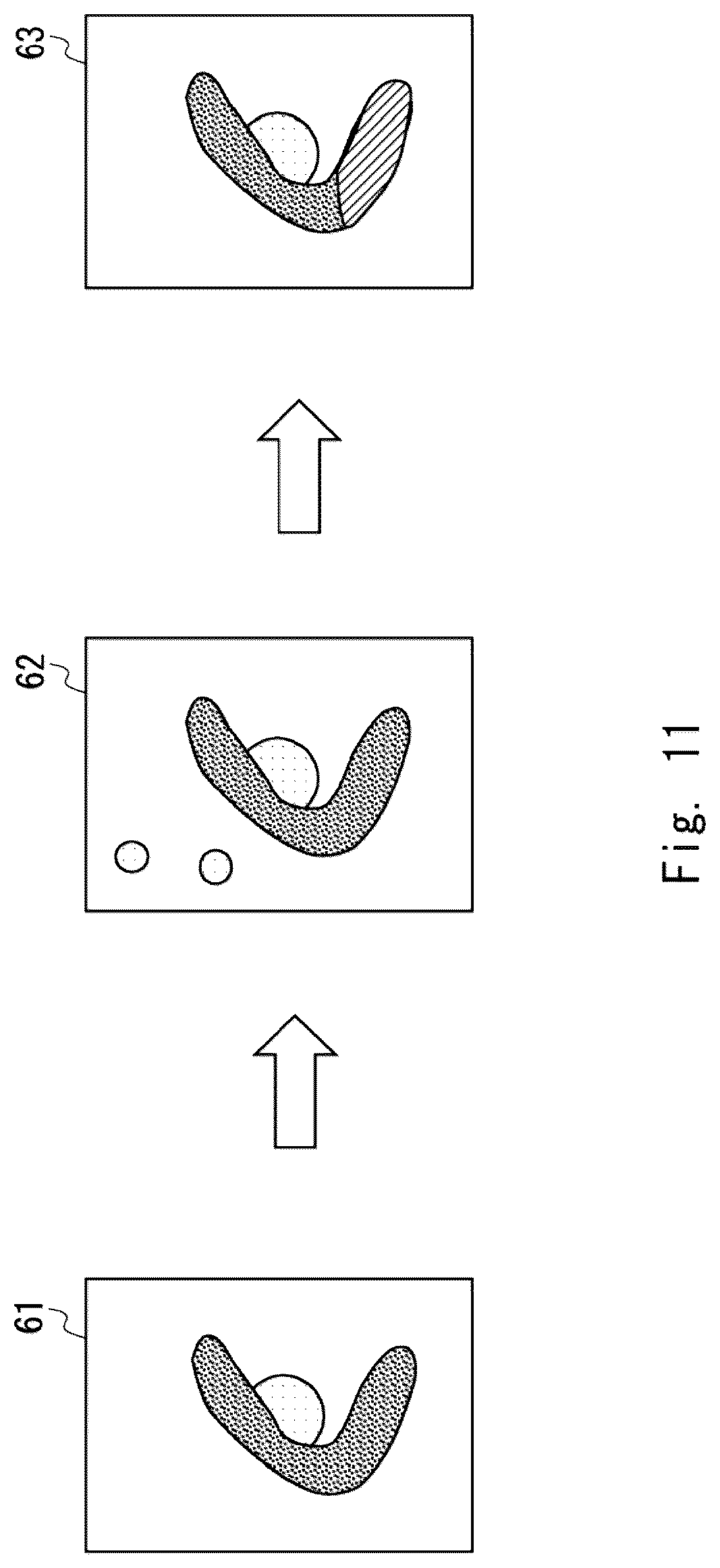Patent US12611200 Figure 11 – Excrement analysis apparatus, analysis system, server apparatus, analysis method, and non-transitory computer-readable medium